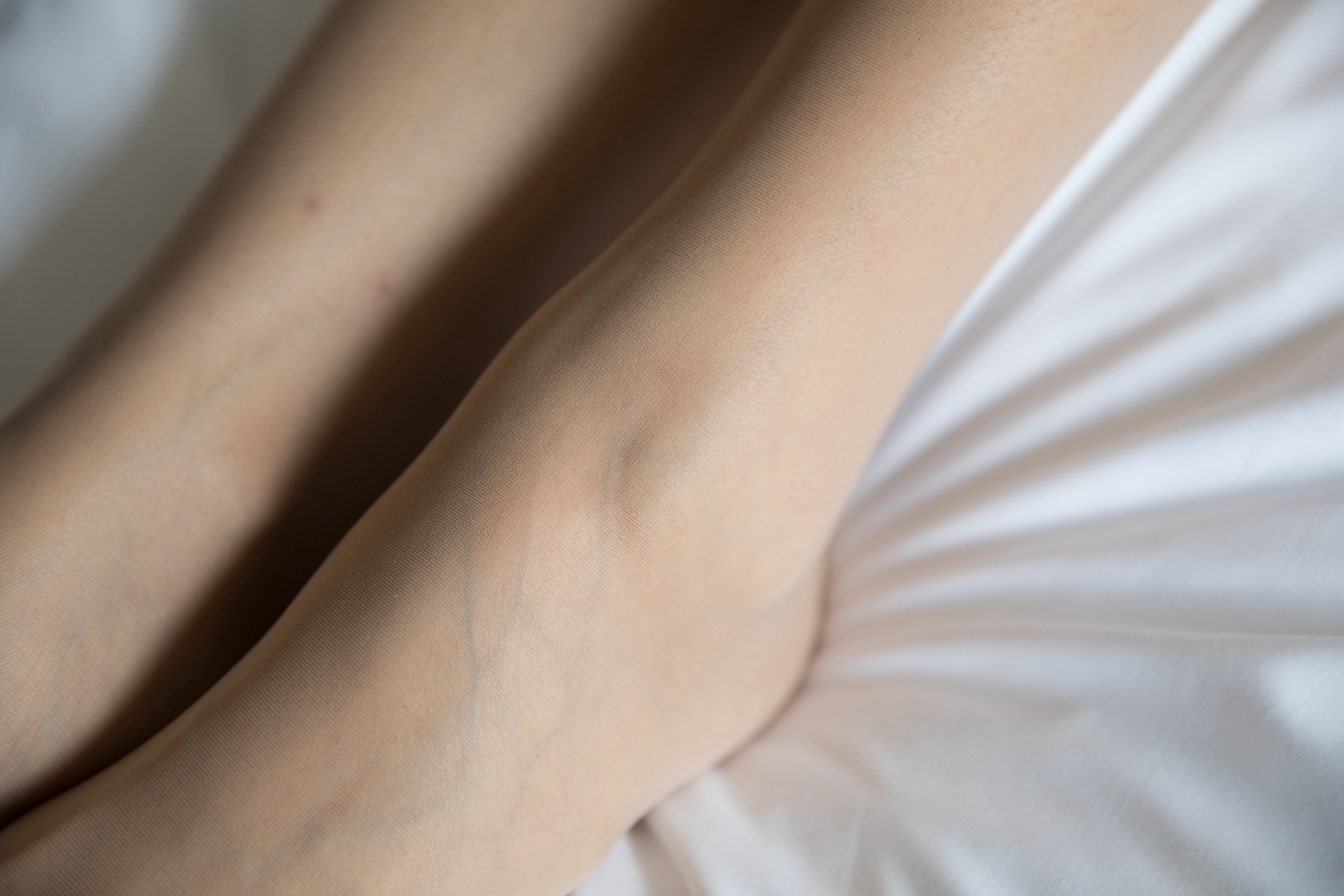 图片[112]-物恋传媒 No.216 柠檬-做自己的骑士 [117P] – 速更版-美库