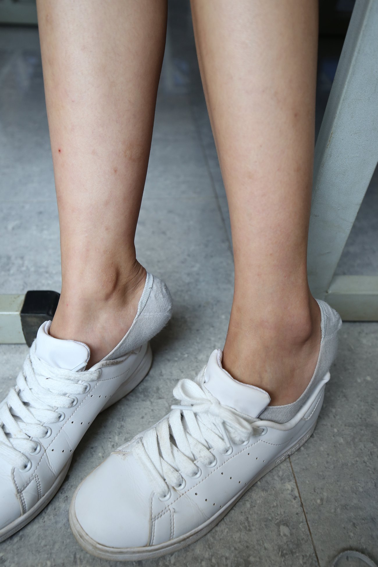 图片[84]-大西瓜爱牙膏-早期作品-S025 201709 女2 棉 [121P] – 速更版-美库