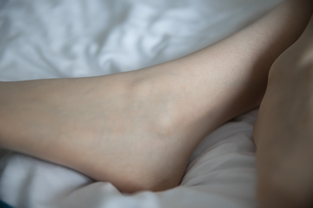 图片[94]-物恋传媒 NO.239 猫耳-甜的泪水[143P] – 速更版-美库