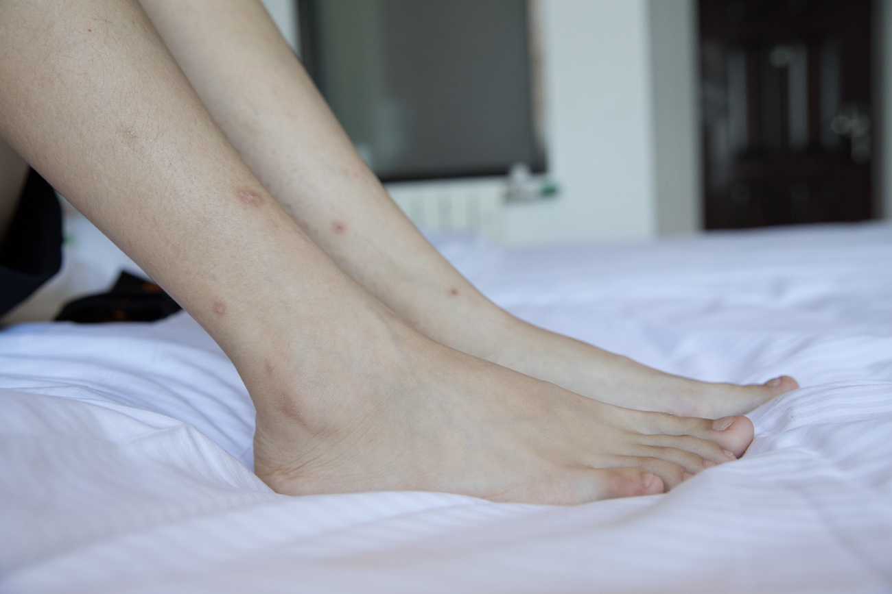 图片[151]-物恋传媒 No.245 雨点-超A运动风 [174P] – 速更版-美库