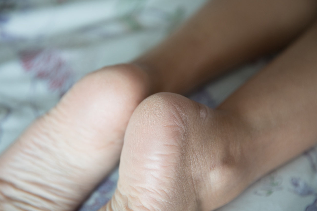 图片[139]-物恋传媒 NO.252 柠檬-黑夜的启明星[170P] – 速更版-美库