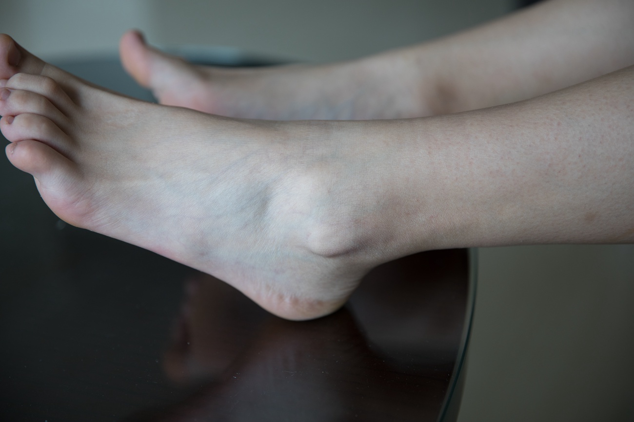 图片[181]-物恋传媒 No.295 小飞-俏丽的懵懂 [193P] – 速更版-美库