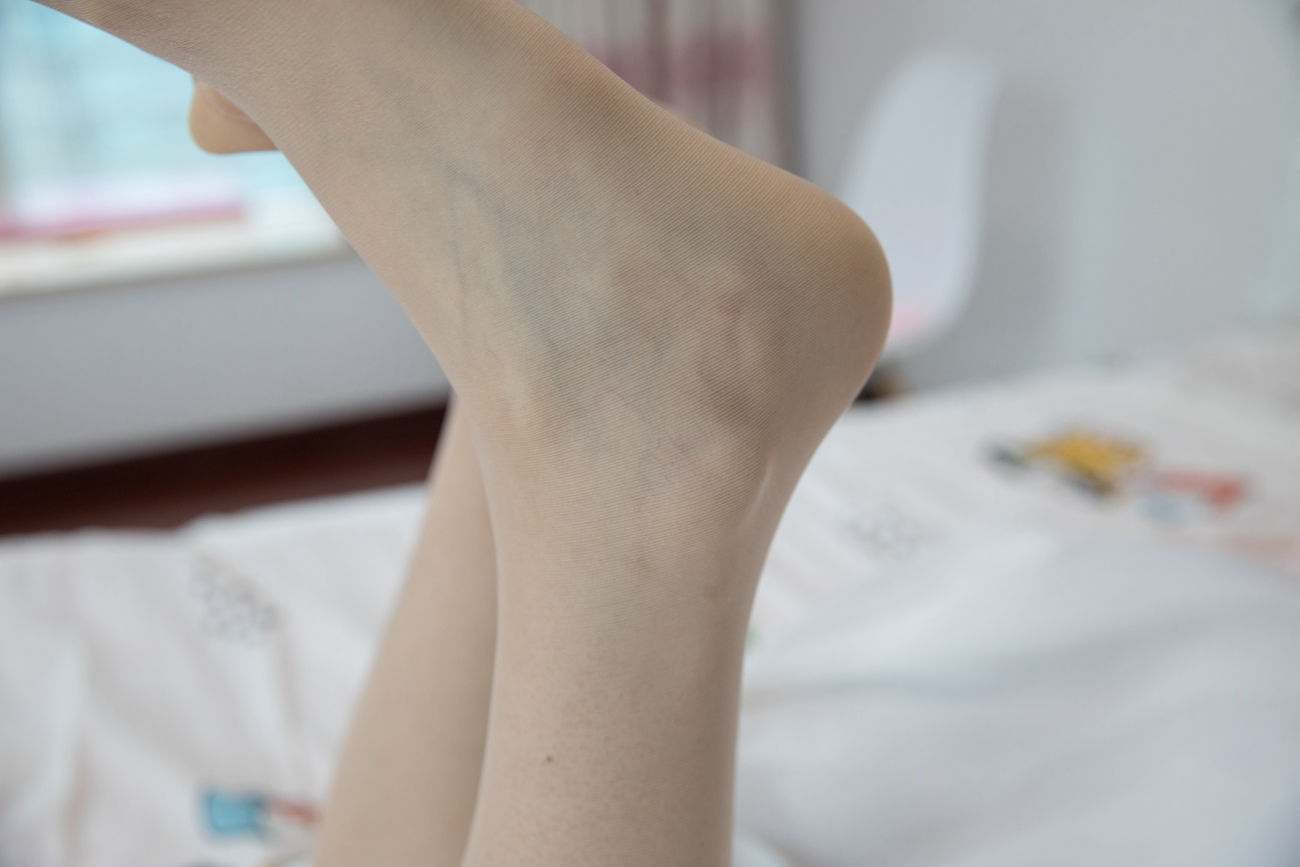 图片[132]-物恋传媒 NO.401 猫耳-樱之白[150P] – 速更版-美库