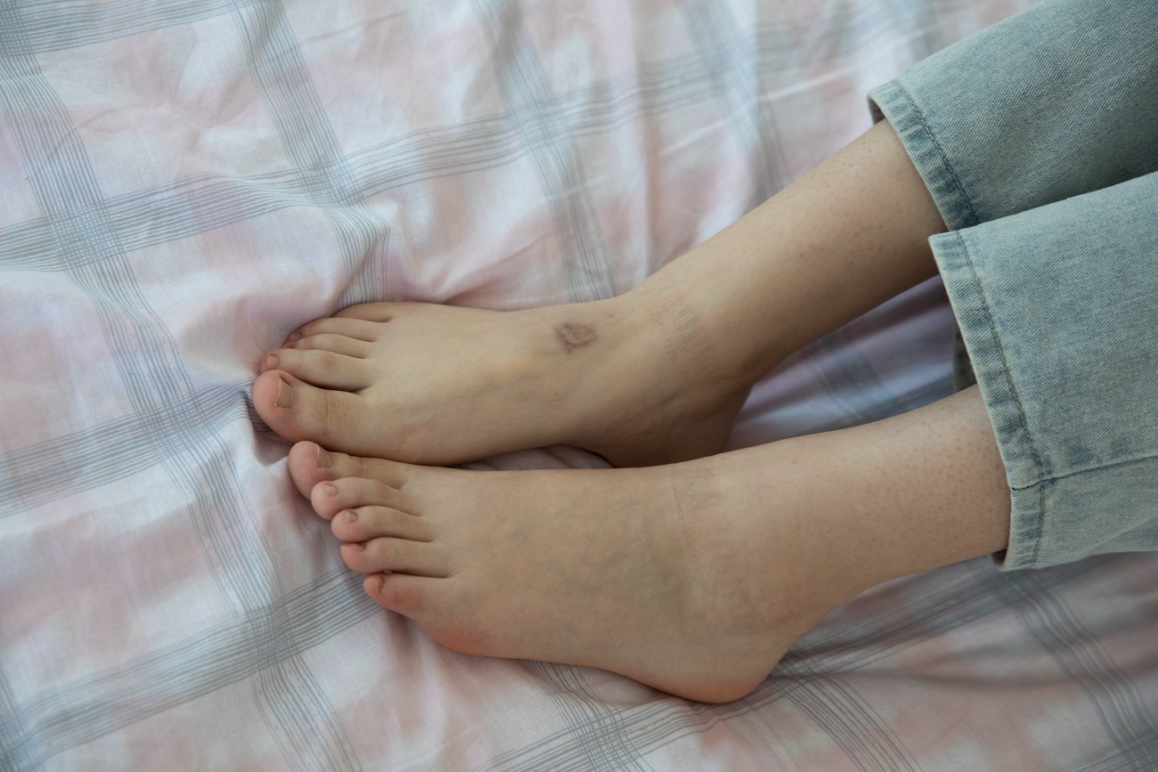 图片[120]-物恋传媒 NO.480 小云-生如夏花[155P] – 速更版-美库