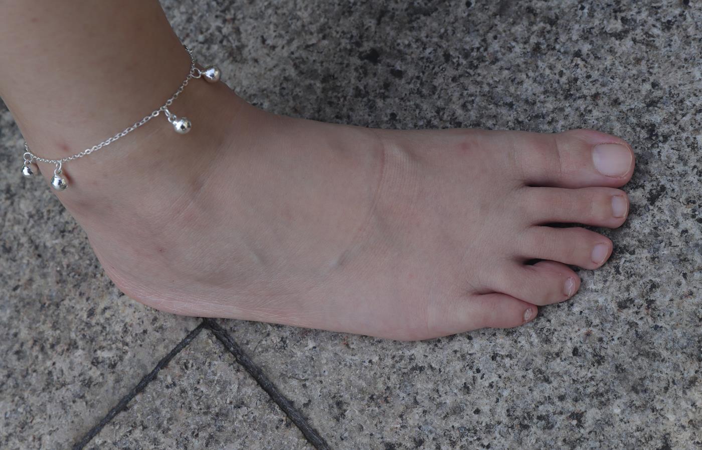 图片[15]-Pary摄影 NO.001 大美女慧婷公园展示美脚 (1) [84P] – 速更版-美库