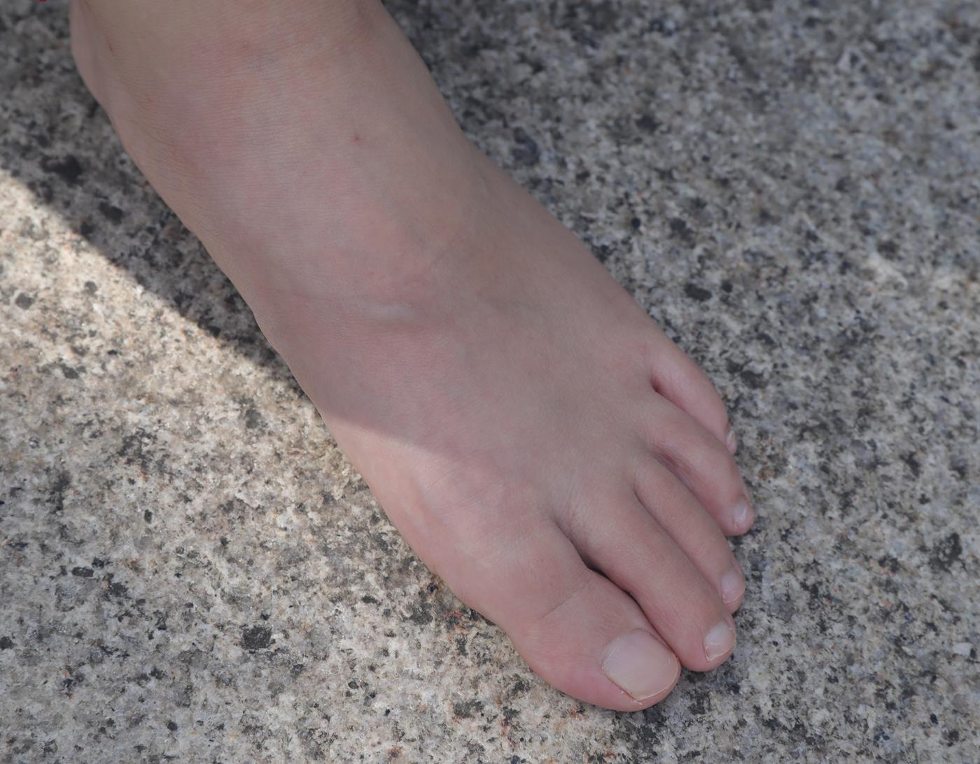 图片[21]-Pary摄影 NO.001 大美女慧婷公园展示美脚 (1) [84P] – 速更版-美库