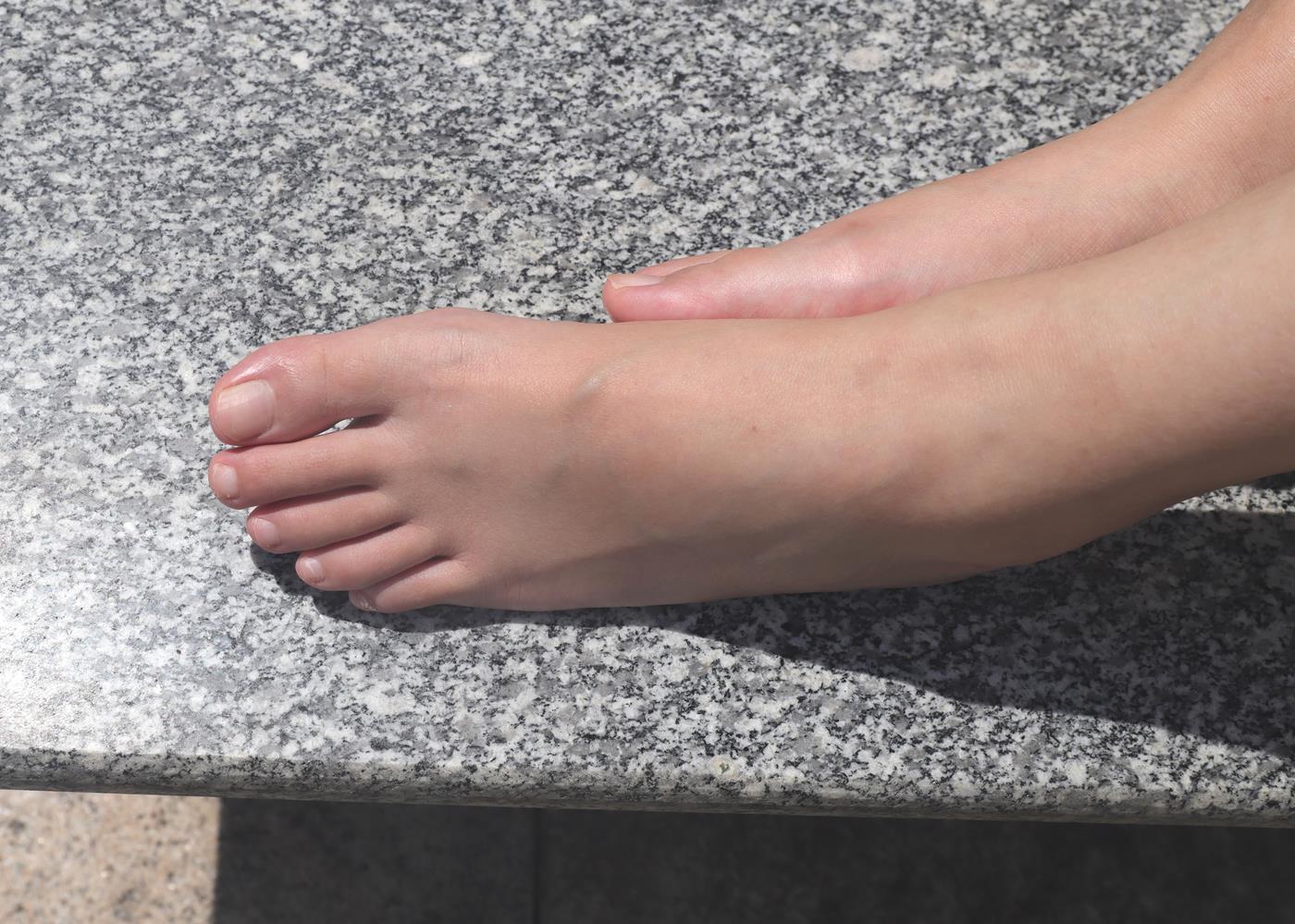 图片[67]-Pary摄影 NO.001 大美女慧婷公园展示美脚 (2) [69P] – 速更版-美库