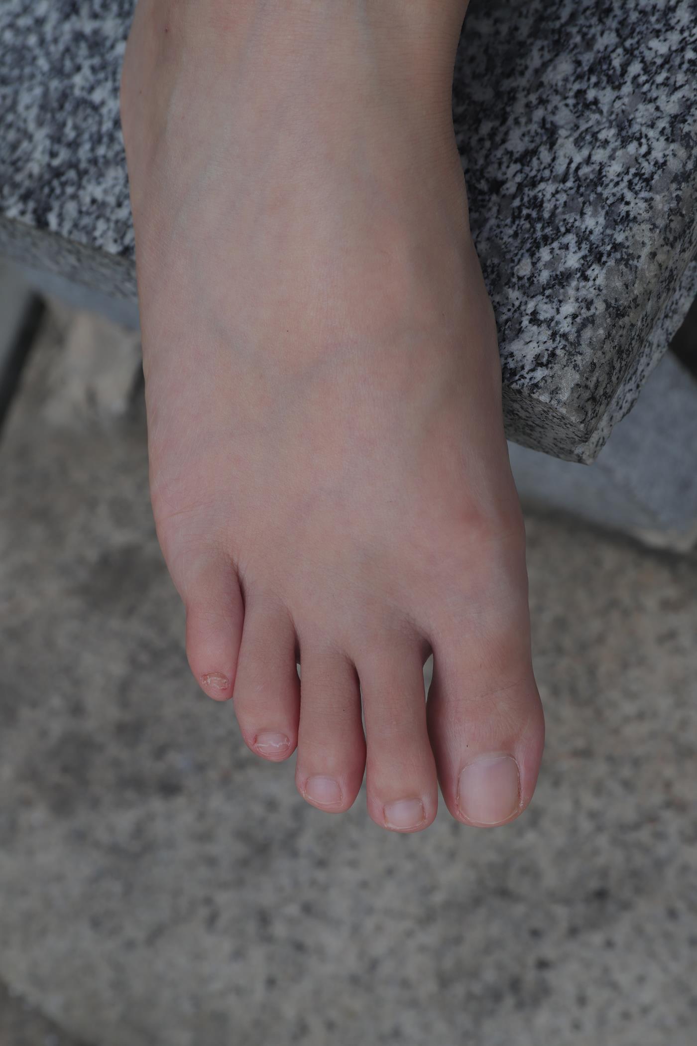 图片[78]-Pary摄影 NO.001 大美女慧婷公园展示美脚 (1) [84P] – 速更版-美库