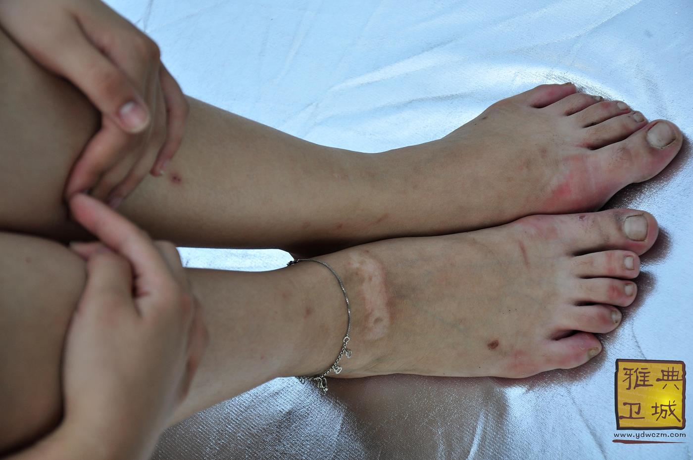 图片[50]-雅典卫城 和夏天谈一个甜甜的恋爱 2010-044 (3) [107P] – 速更版-美库