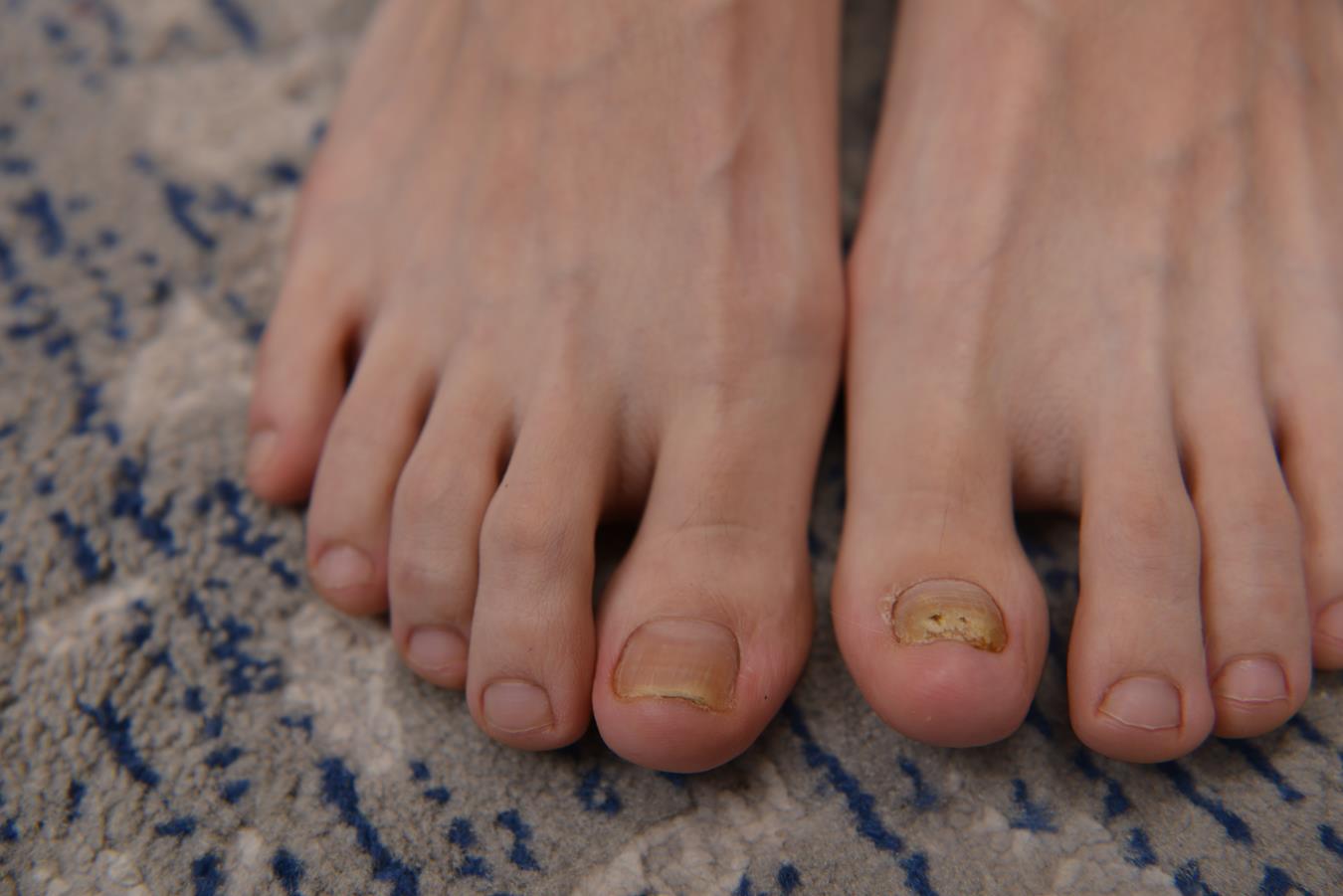 图片[60]-[Sexy Asian Girls Feet] No.005 大脚妹沫沫的大脚丫 [158P] – 速更版-美库