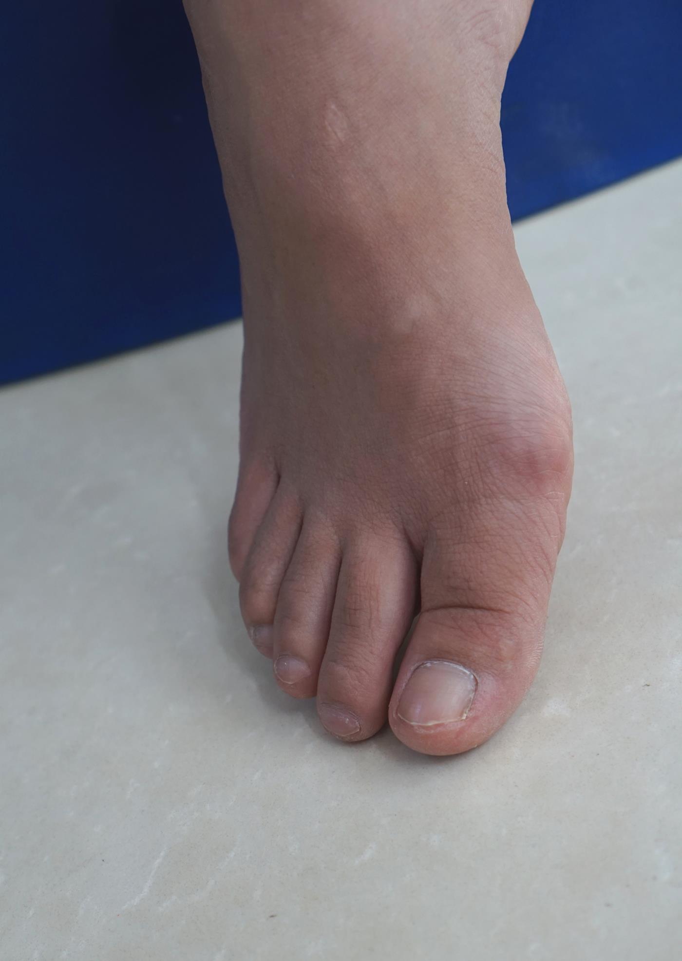 图片[39]-[Pary学生模拍] No.039 小燕的37码美jiao [77P] – 速更版-美库