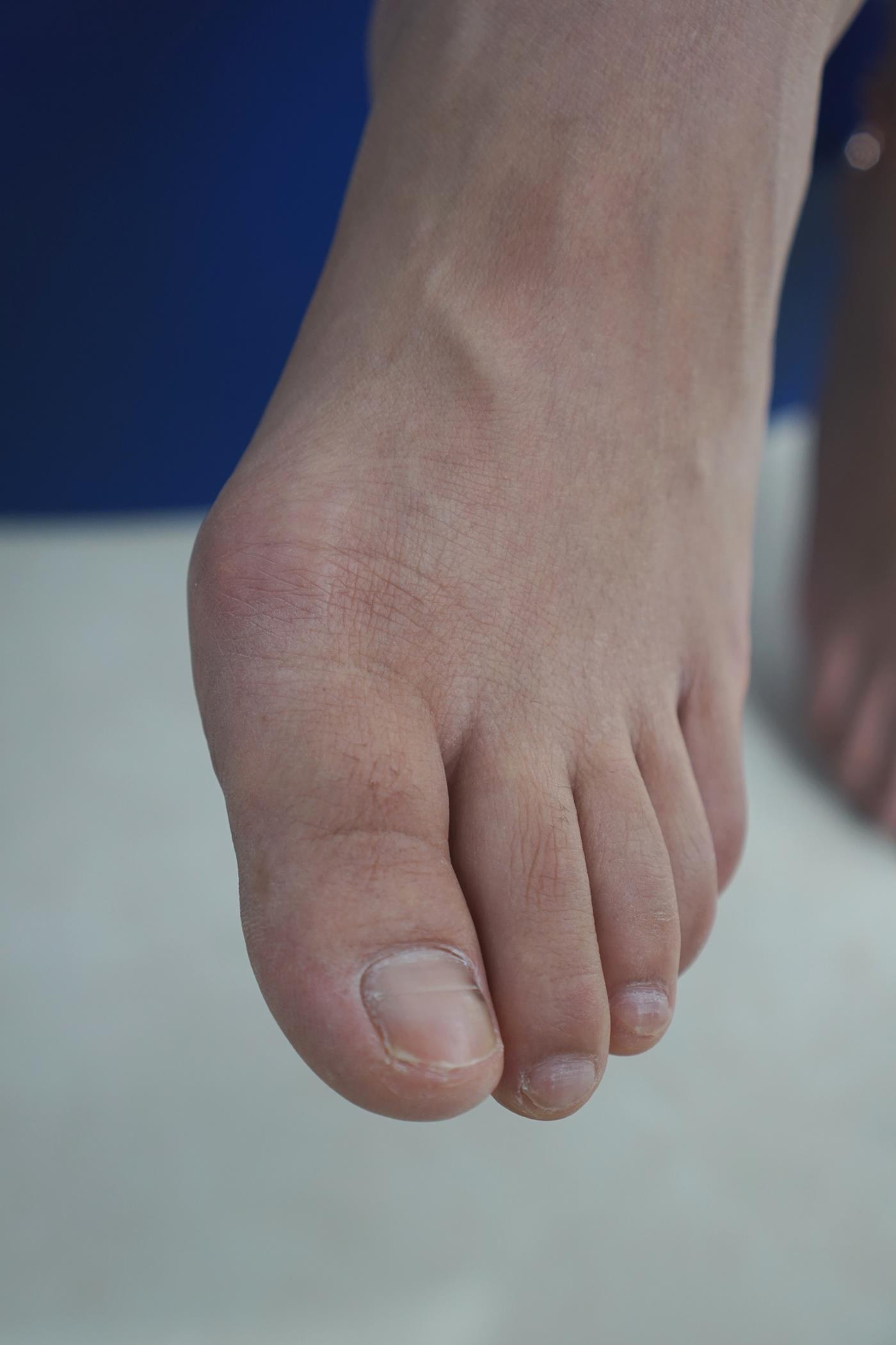 图片[42]-[Pary学生模拍] No.039 小燕的37码美jiao [77P] – 速更版-美库