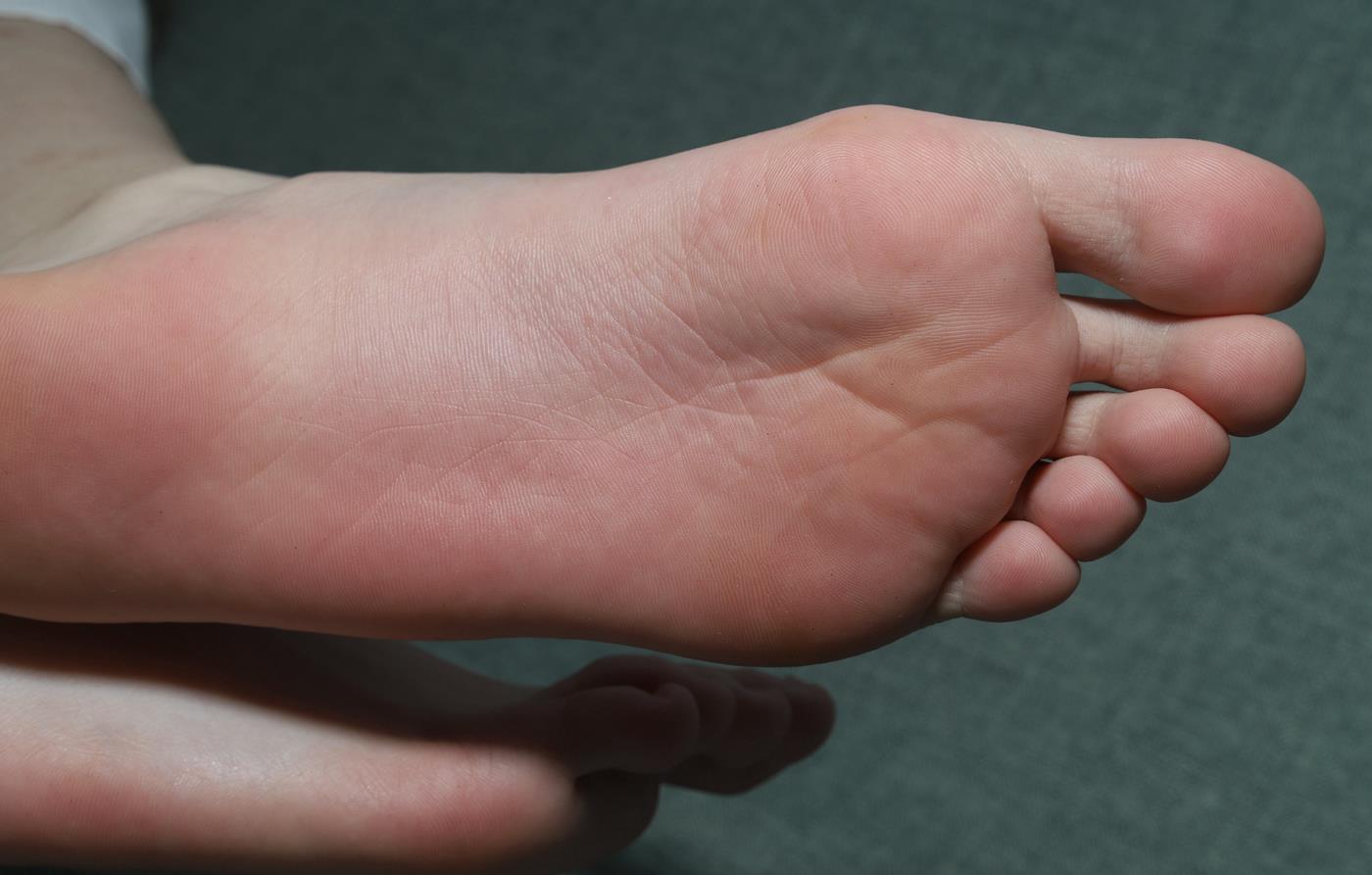 图片[60]-[Pary学生模拍] No.042 大美女琪琪的脚底被挠红了 [100P] – 速更版-美库