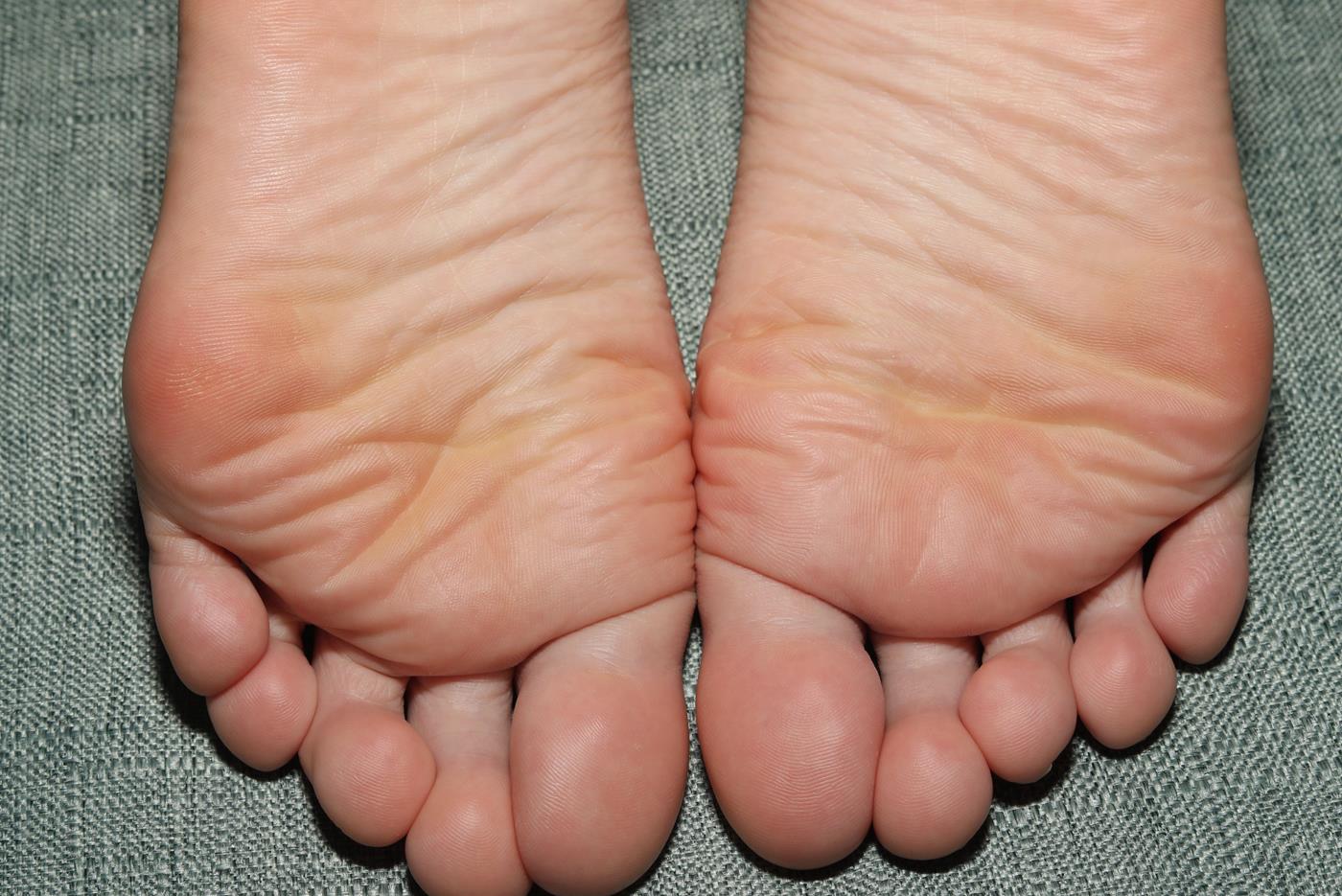 图片[30]-[Pary学生模拍] No.046 大美女琪琪脚底大餐，近距离脚底特写 [130P] – 速更版-美库