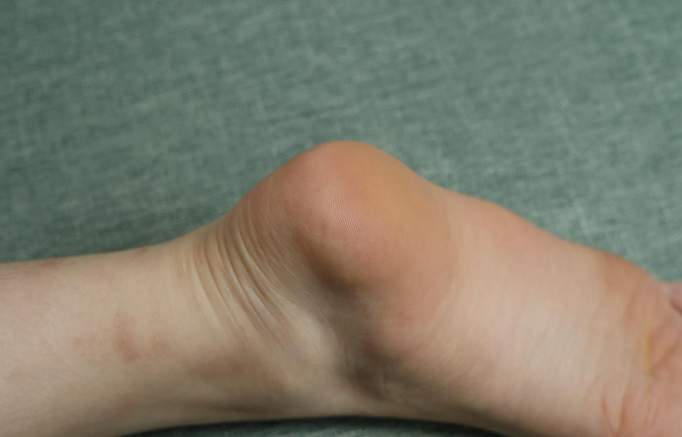 图片[102]-[Pary学生模拍] No.046 大美女琪琪脚底大餐，近距离脚底特写 [130P] – 速更版-美库