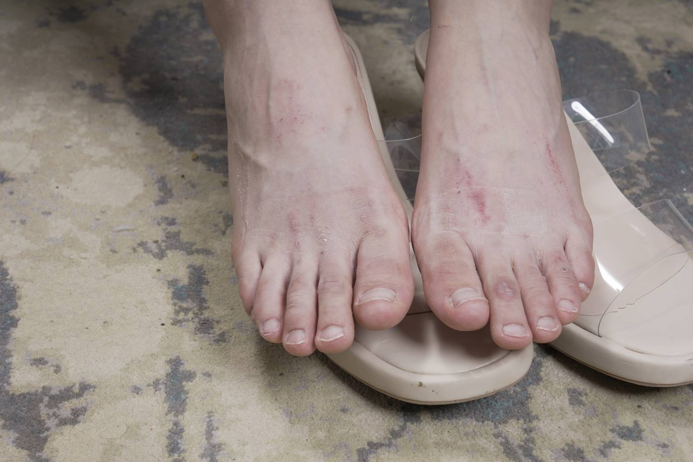 图片[11]-[Sexy Asian Girls Feet] NO.031 小女生令仪展示她的有伤痕但挺姓感的脚丫子 裸足 [143P] – 速更版-美库