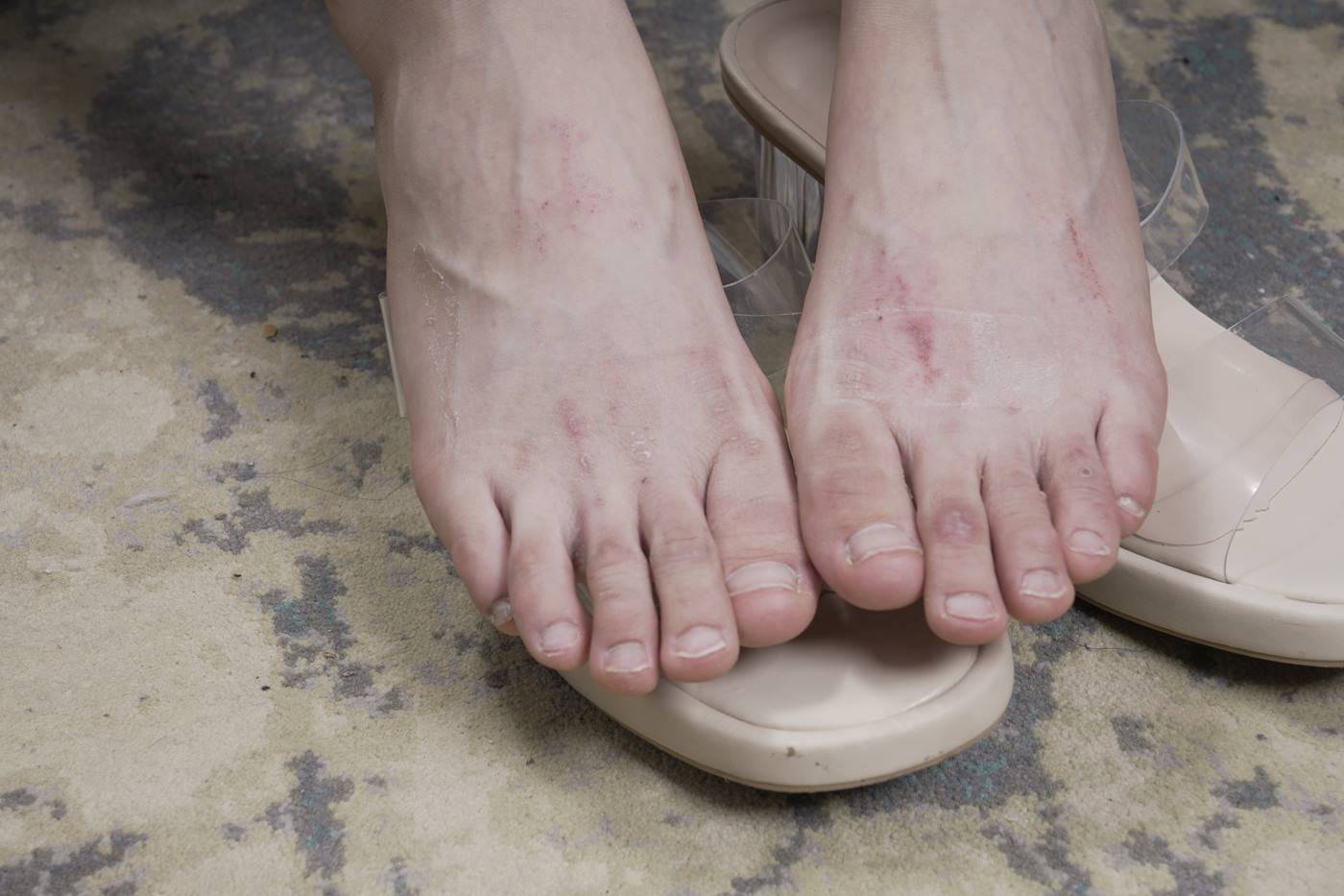 图片[12]-[Sexy Asian Girls Feet] NO.031 小女生令仪展示她的有伤痕但挺姓感的脚丫子 裸足 [143P] – 速更版-美库