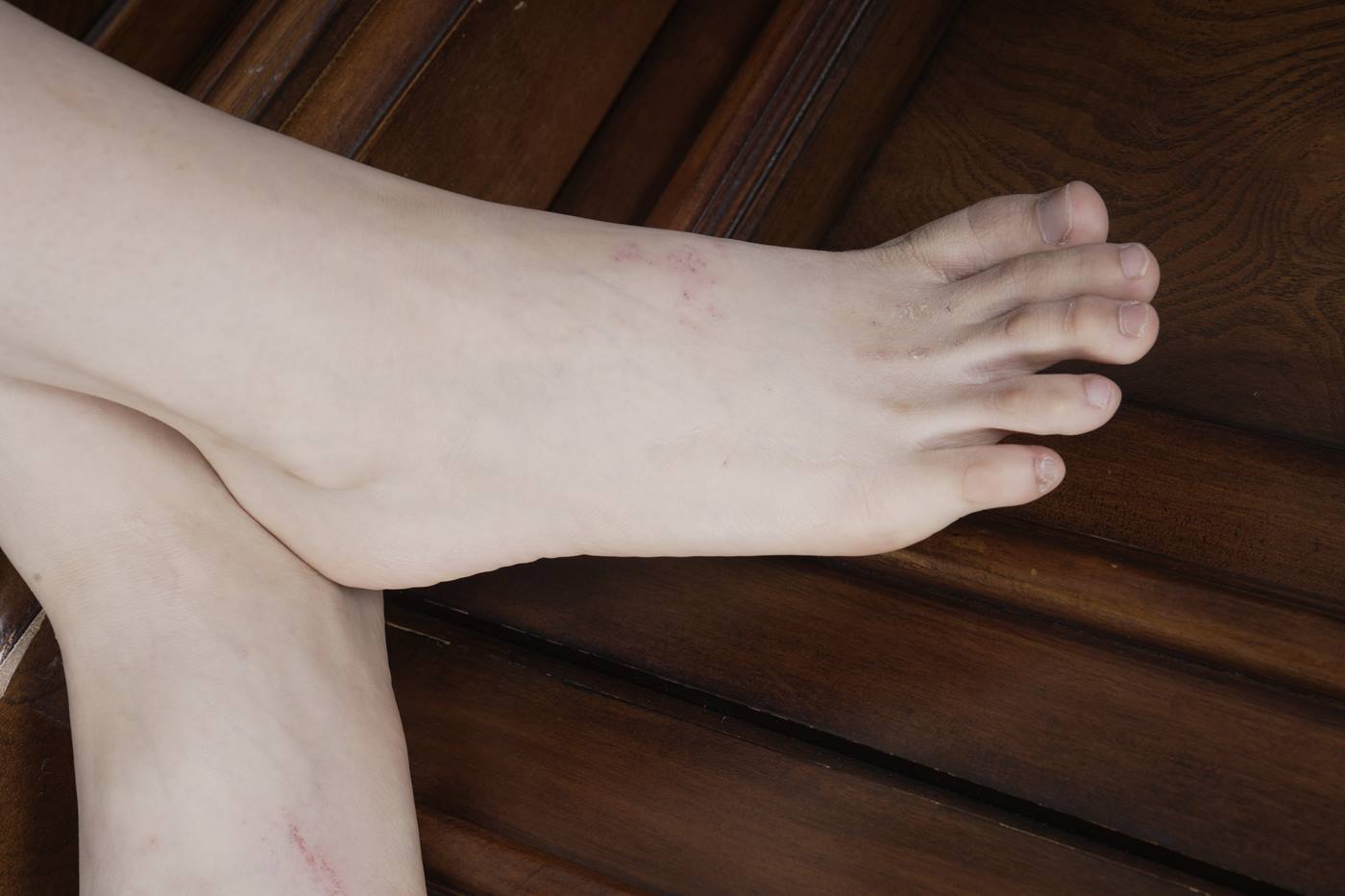 图片[37]-[Sexy Asian Girls Feet] NO.031 小女生令仪展示她的有伤痕但挺姓感的脚丫子 裸足 [143P] – 速更版-美库