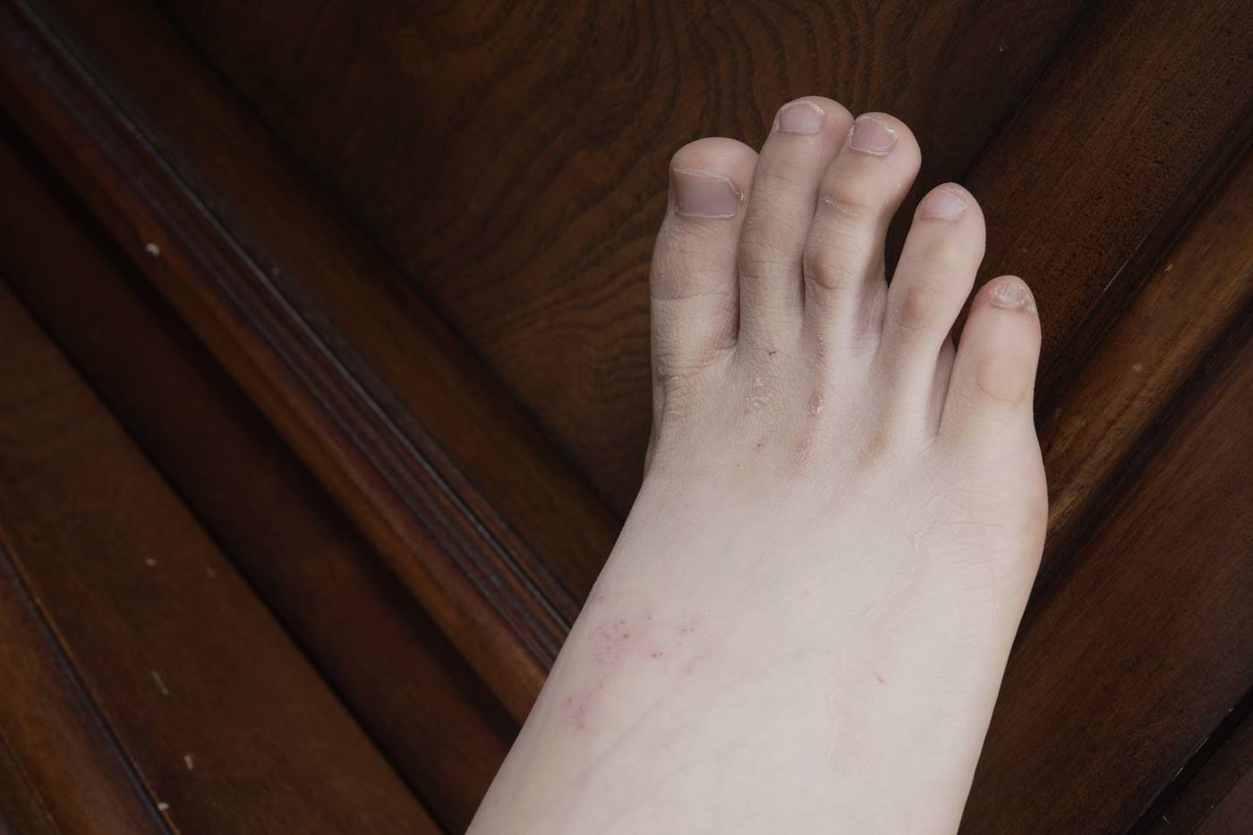 图片[38]-[Sexy Asian Girls Feet] NO.031 小女生令仪展示她的有伤痕但挺姓感的脚丫子 裸足 [143P] – 速更版-美库