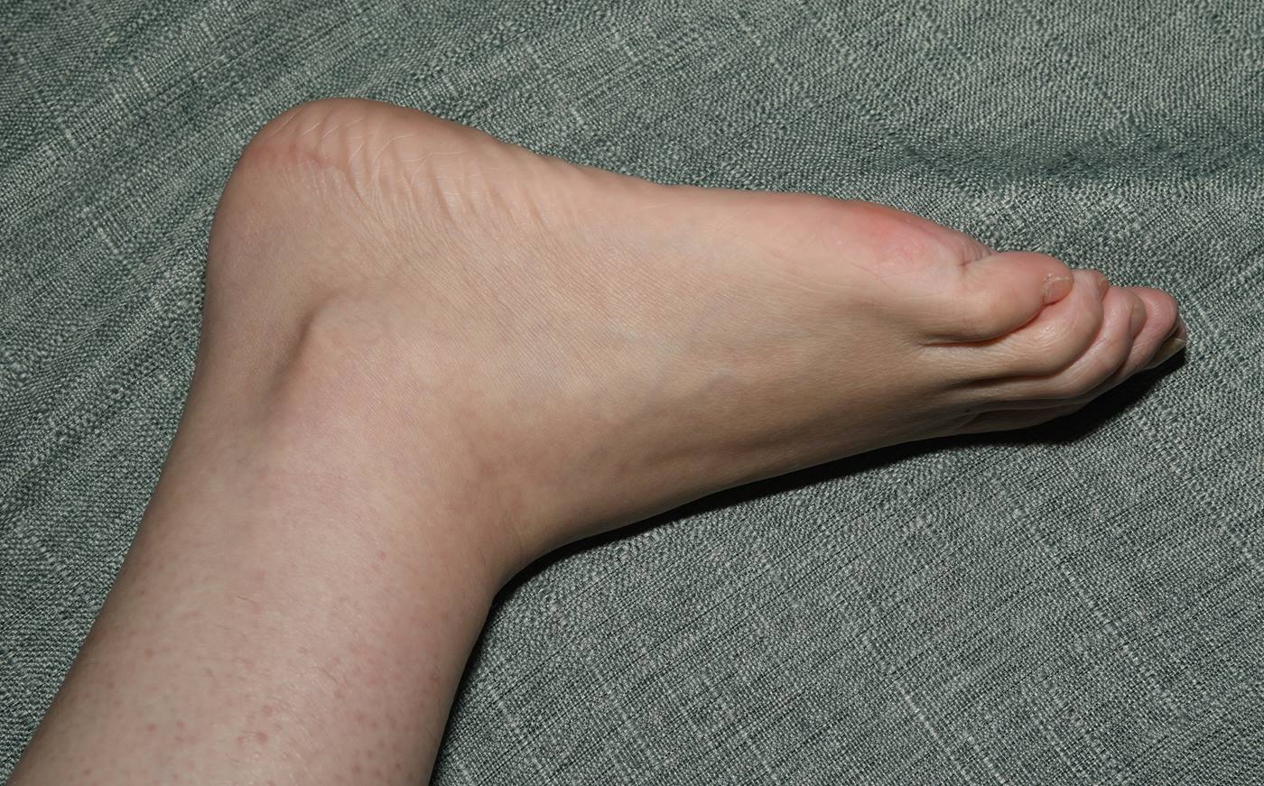 图片[104]-[Pary学生模拍] No.054 舞蹈系小欧室内展示38码大美jiao [110P] – 速更版-美库