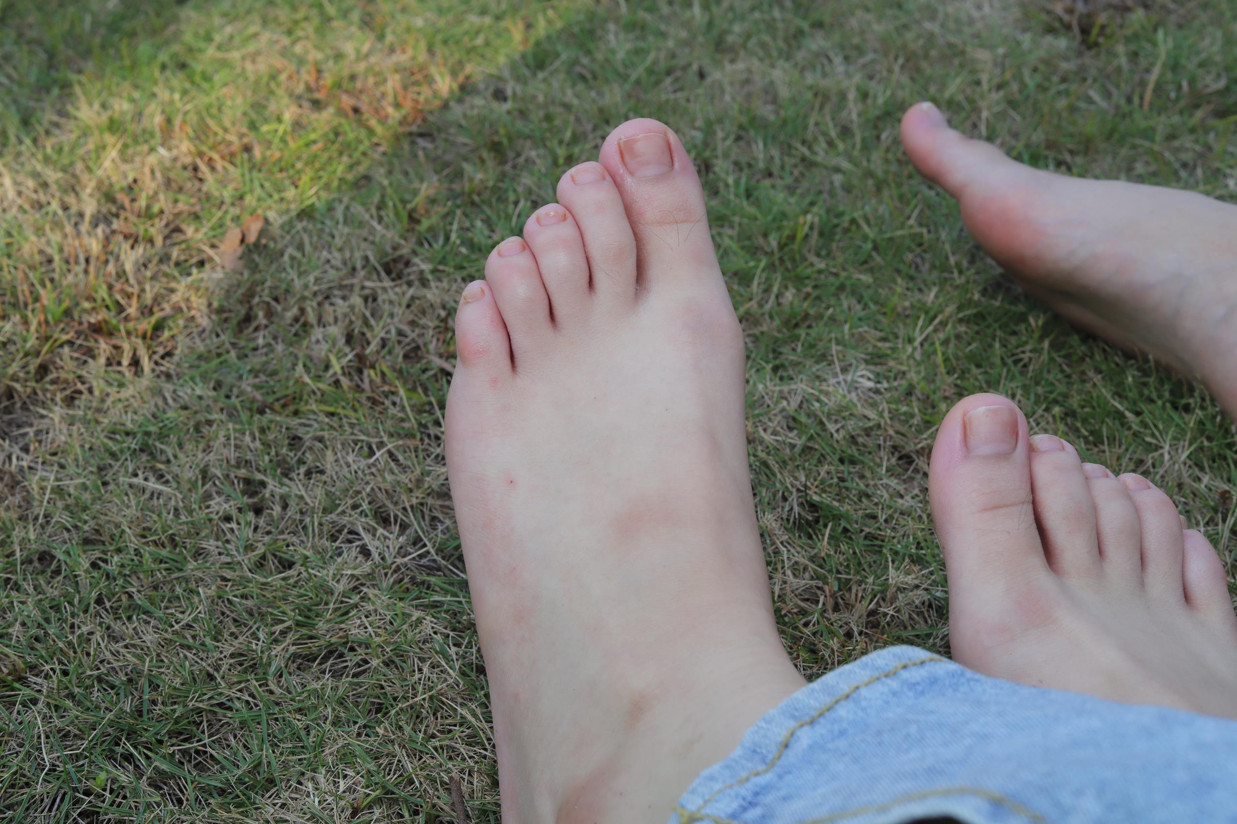 图片[30]-Pary摄影 NO.063 诗诗与小然户外展示原味嫩脚丫[100P] – 速更版-美库