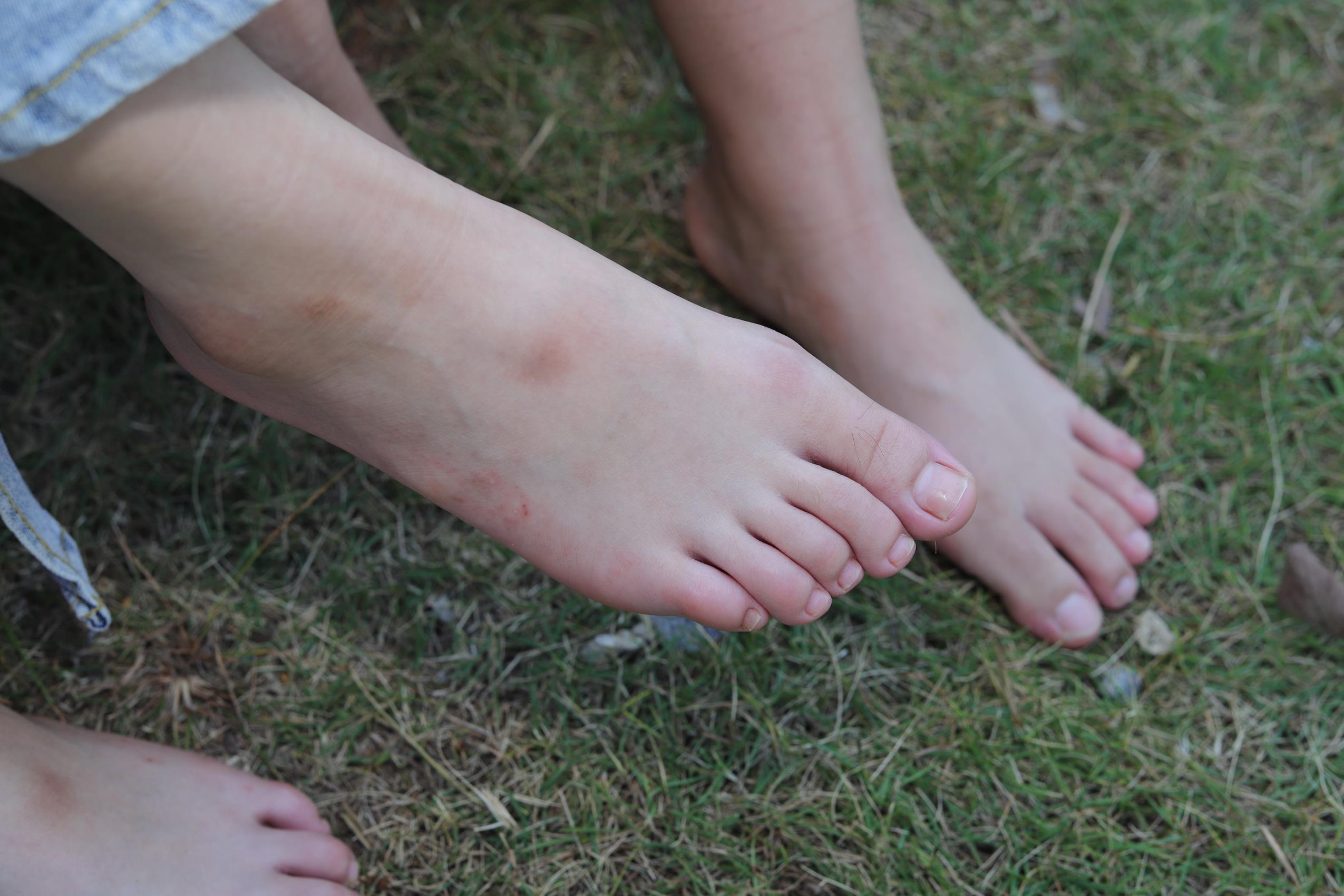 图片[86]-Pary摄影 NO.063 诗诗与小然户外展示原味嫩脚丫[100P] – 速更版-美库