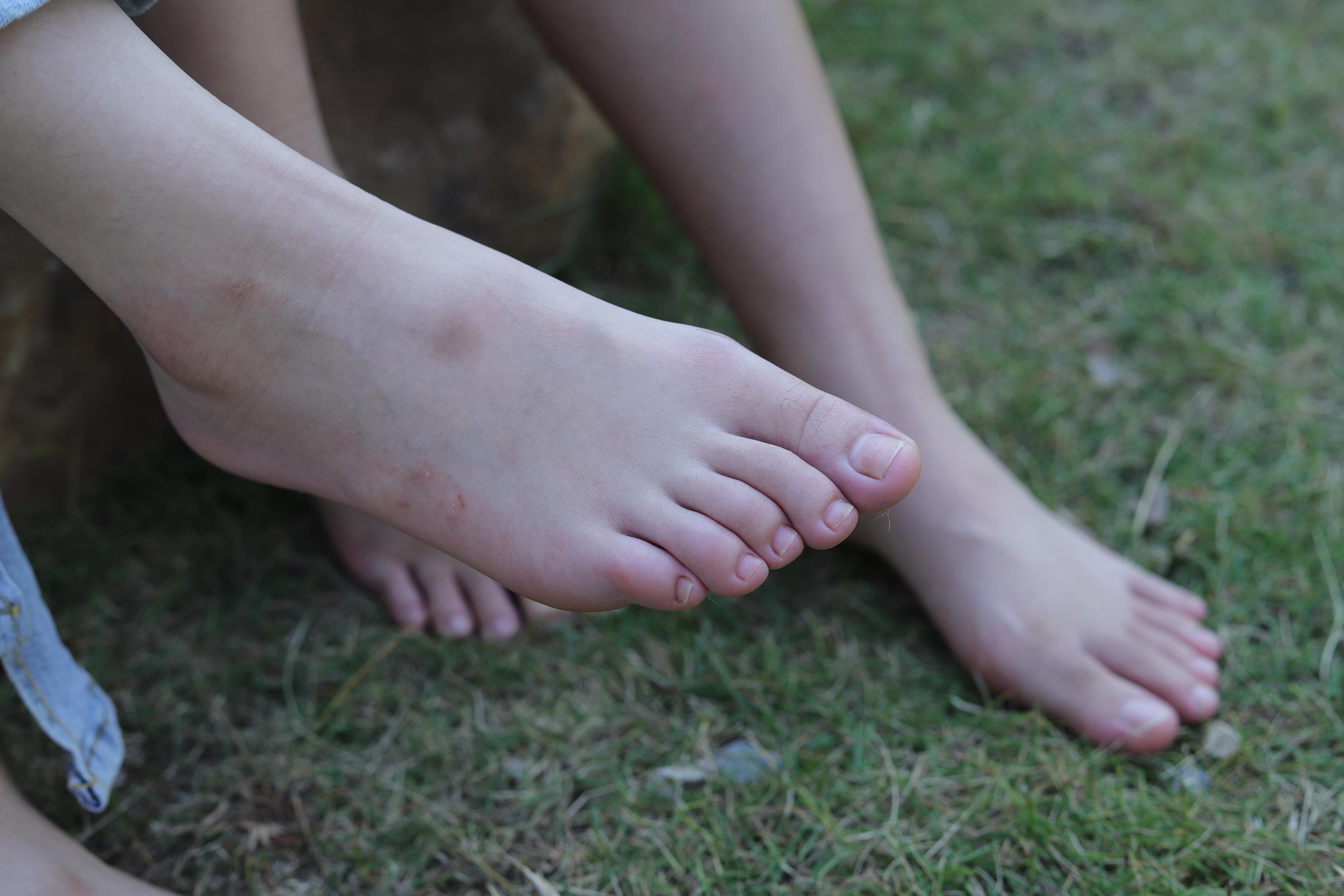 图片[87]-Pary摄影 NO.063 诗诗与小然户外展示原味嫩脚丫[100P] – 速更版-美库