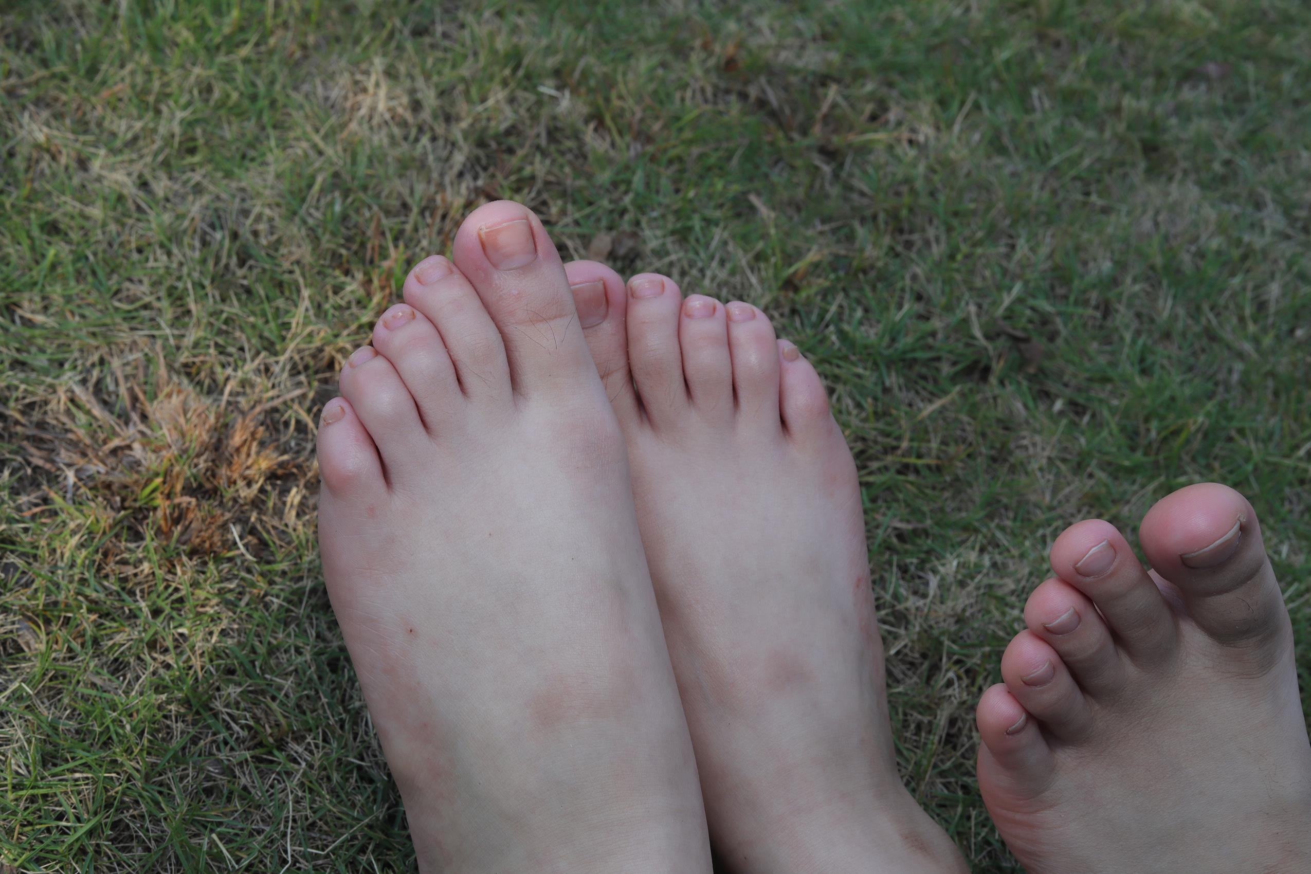 图片[100]-Pary摄影 NO.063 诗诗与小然户外展示原味嫩脚丫[100P] – 速更版-美库