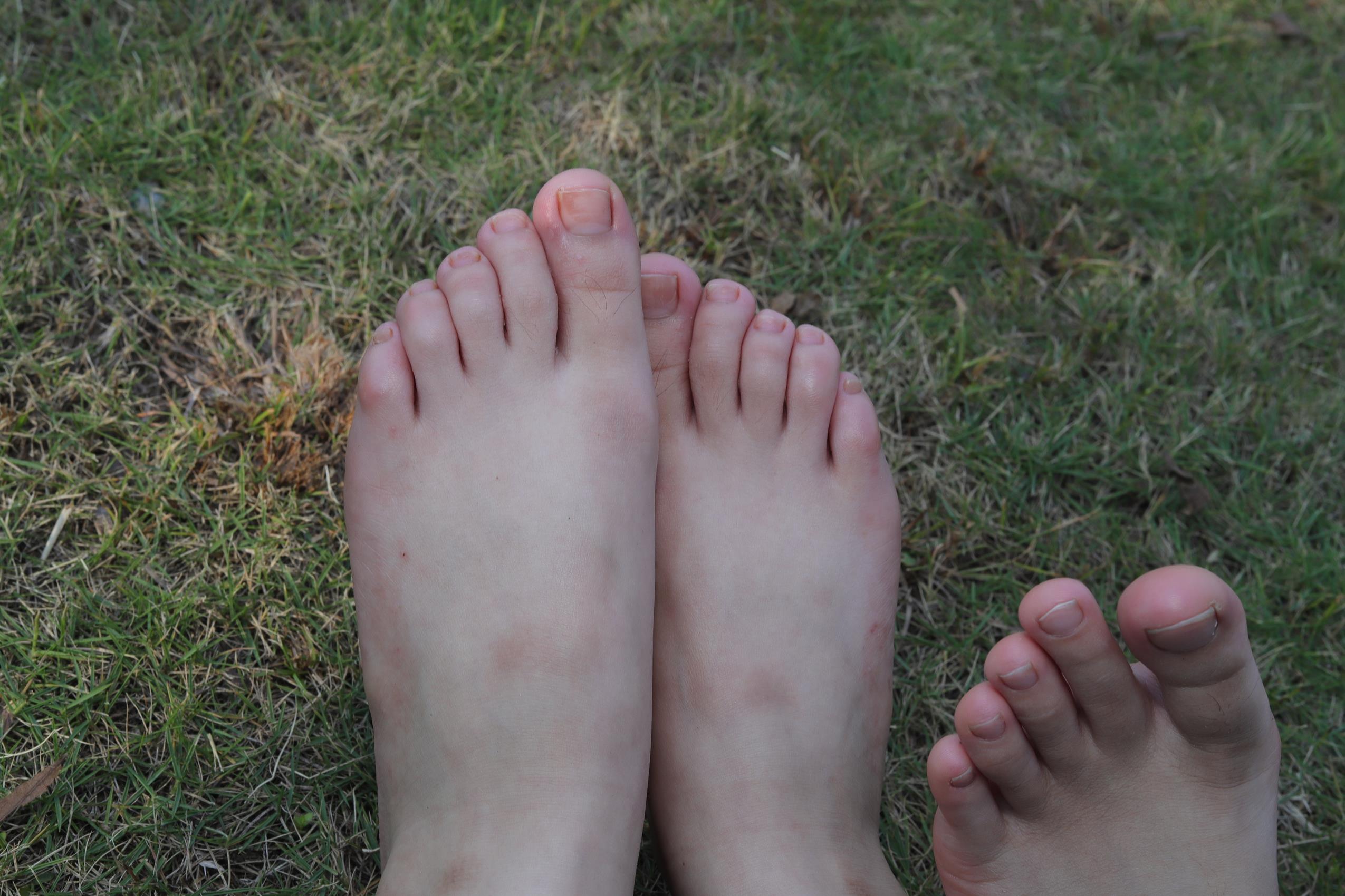 图片[101]-Pary摄影 NO.063 诗诗与小然户外展示原味嫩脚丫[100P] – 速更版-美库