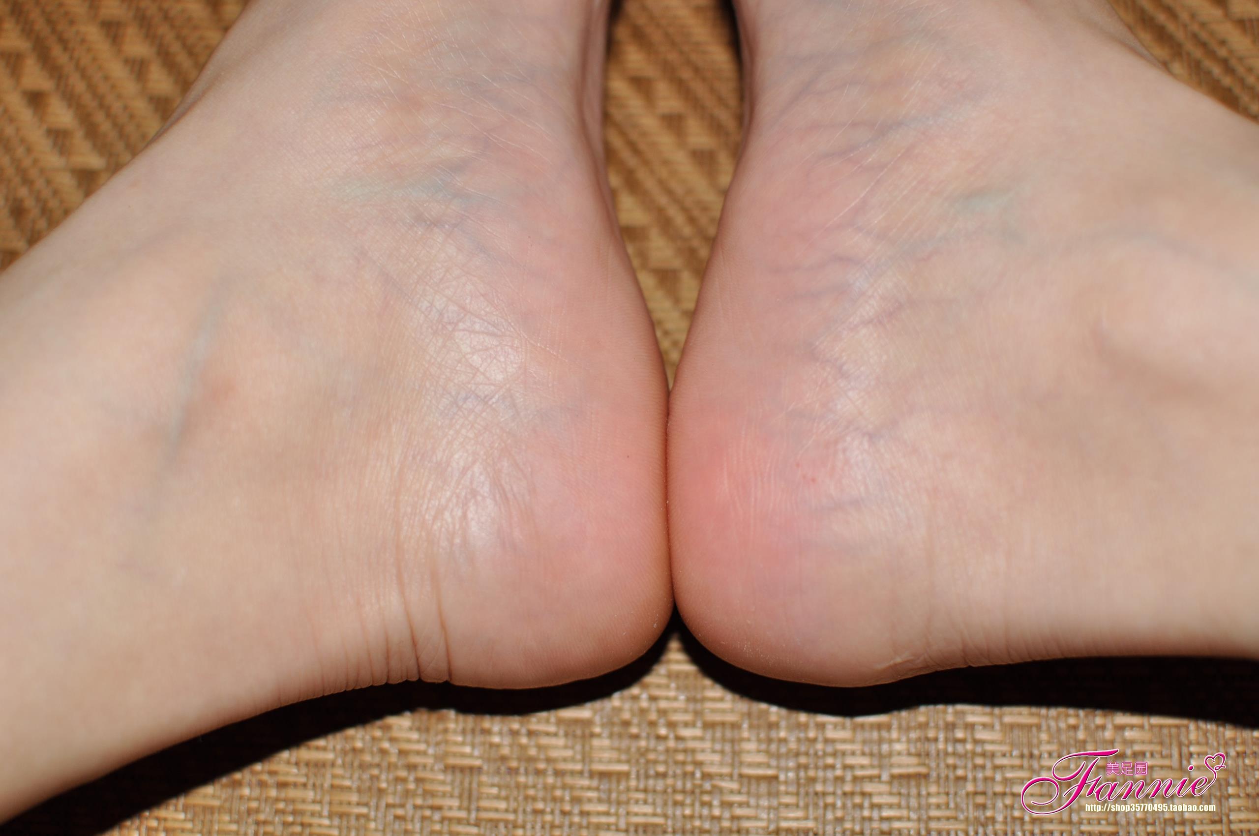 图片[44]-Fannie芬妮每足园 No.270 裸足底特写-2 [71P] – 速更版-美库