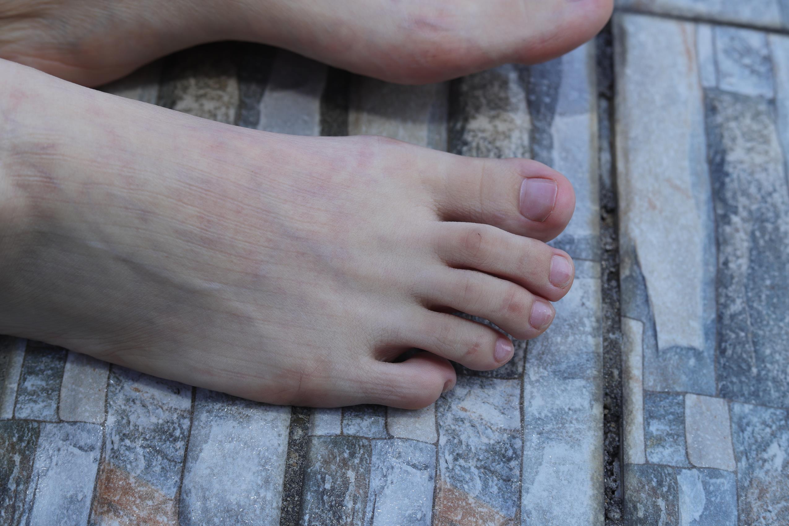 图片[82]-Pary摄影 NO.068 极品美女小芳公园脱掉鞋袜展示极品美脚[86P] – 速更版-美库