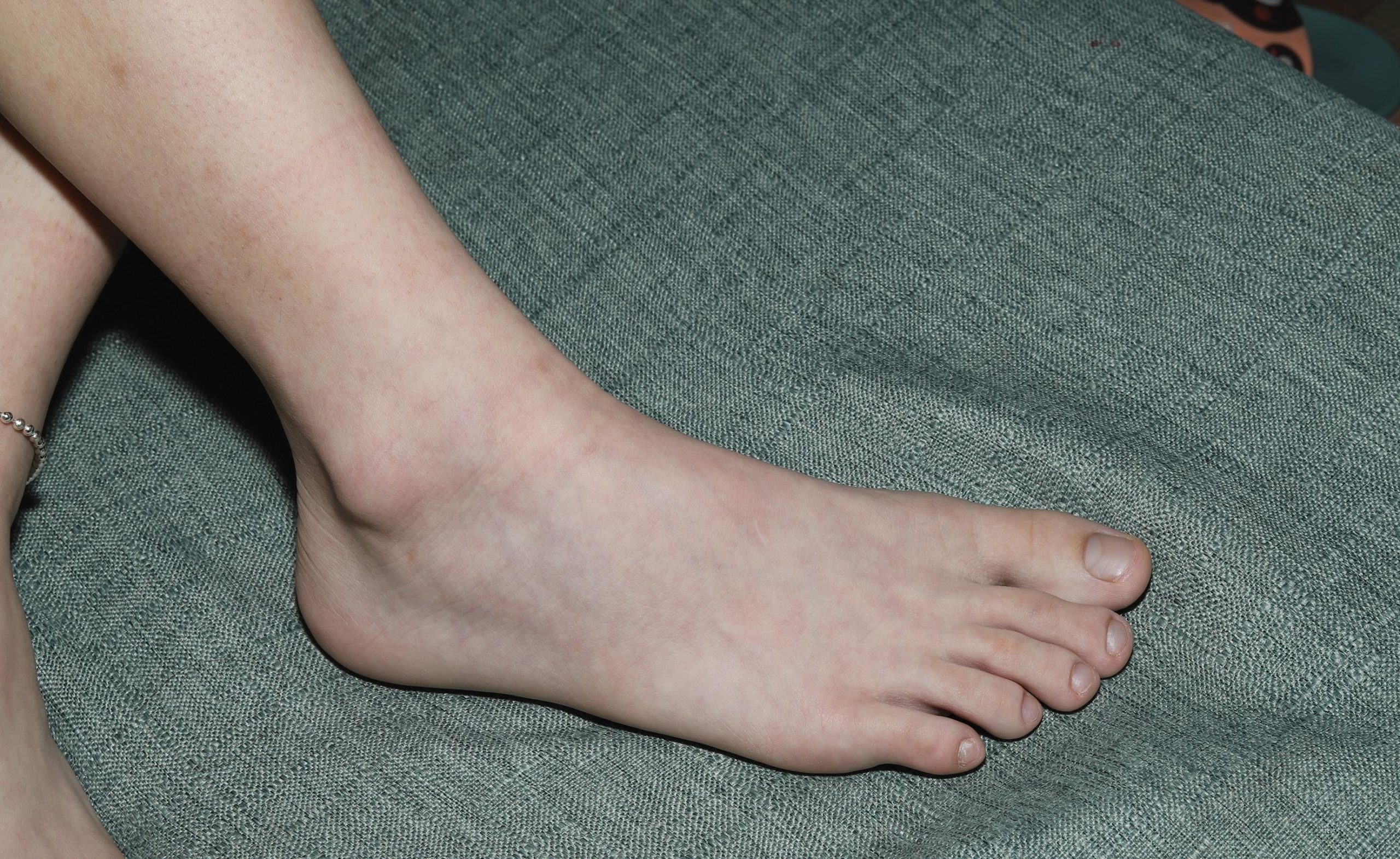 图片[77]-Pary摄影 NO.073 新模小陈展示37码纤薄秀气美脚[99P] – 速更版-美库