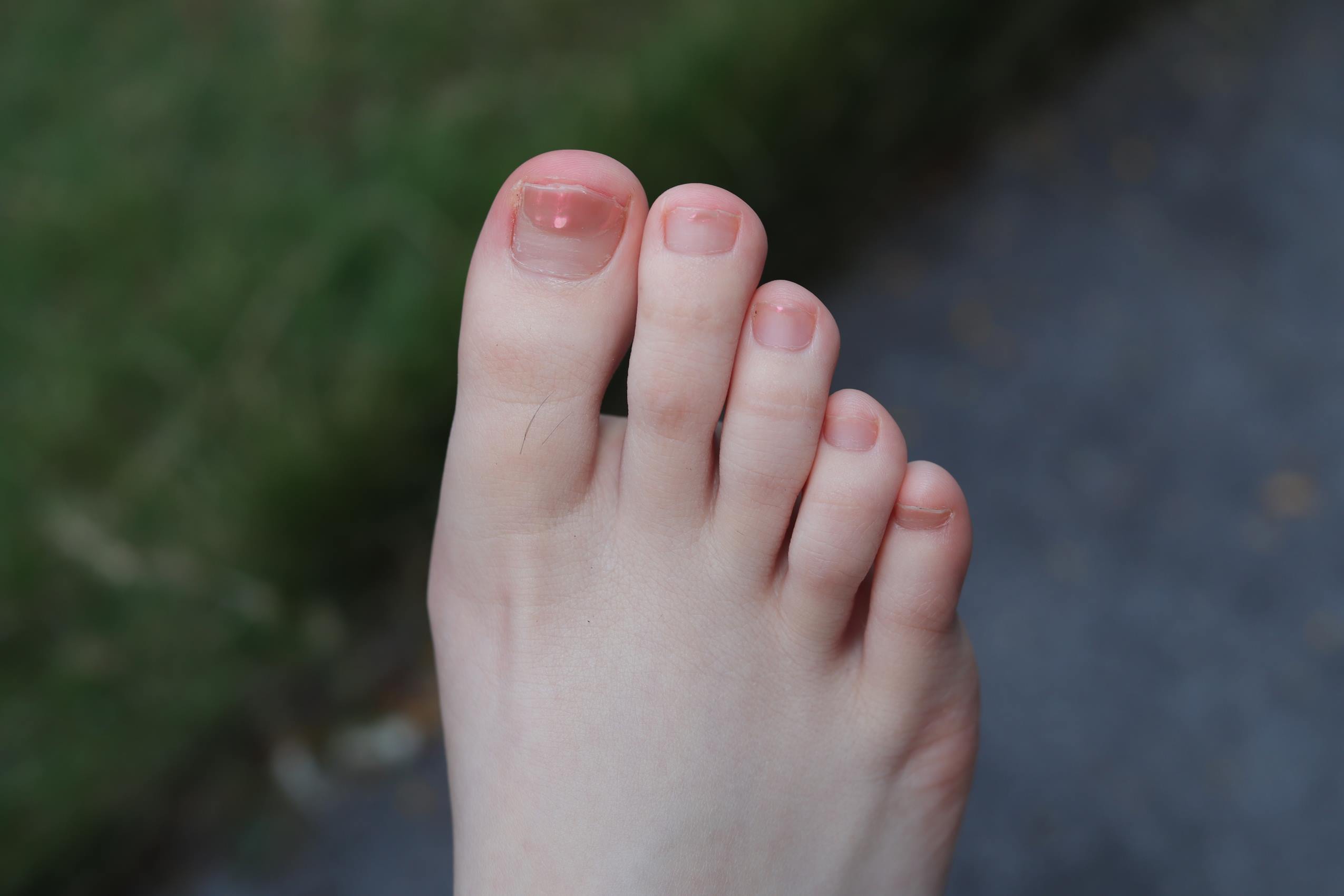 图片[17]-Pary摄影 NO.088 与大美女琪琪到公园游玩拍照[109P] – 速更版-美库