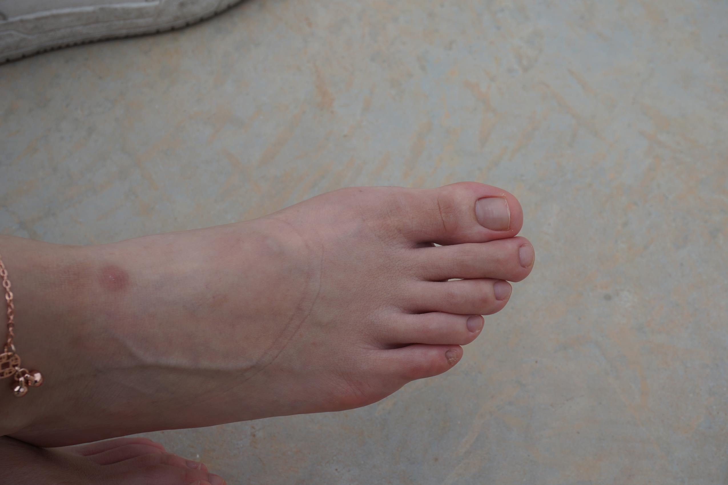 图片[80]-Pary摄影 NO.094 与小金到体育公园拍脚[88P] – 速更版-美库