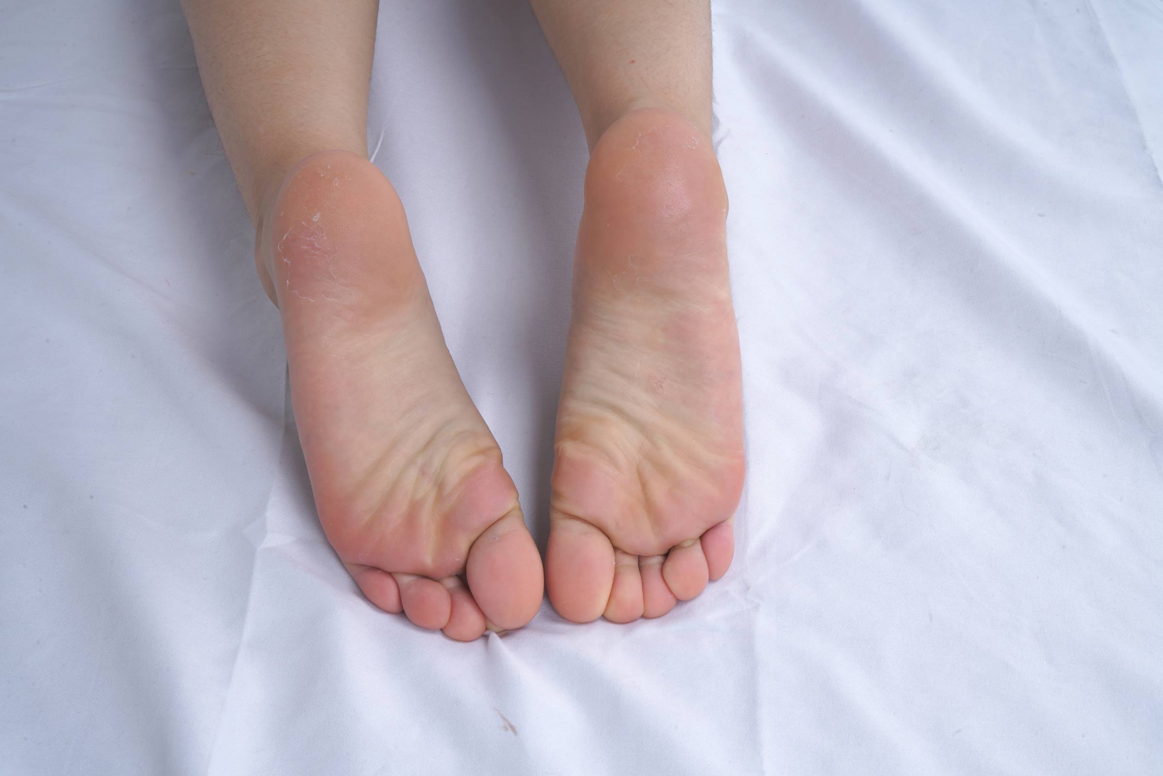 图片[52]-Pary摄影 NO.108 可爱小美女燕玲请吃美脚大餐[103P] – 速更版-美库