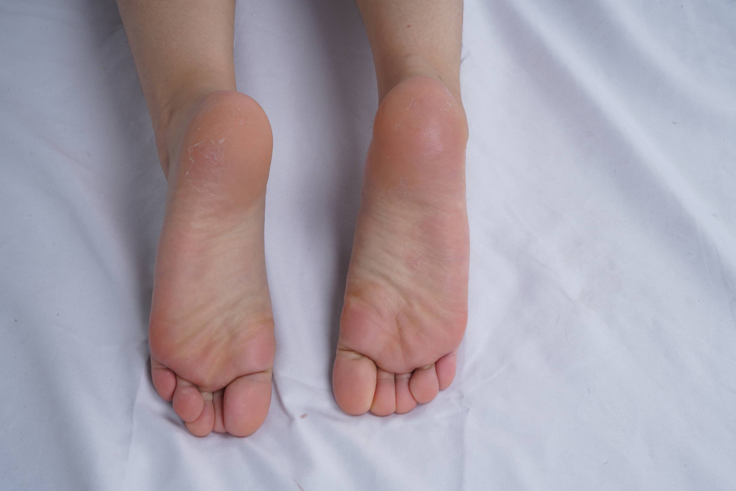 图片[53]-Pary摄影 NO.108 可爱小美女燕玲请吃美脚大餐[103P] – 速更版-美库