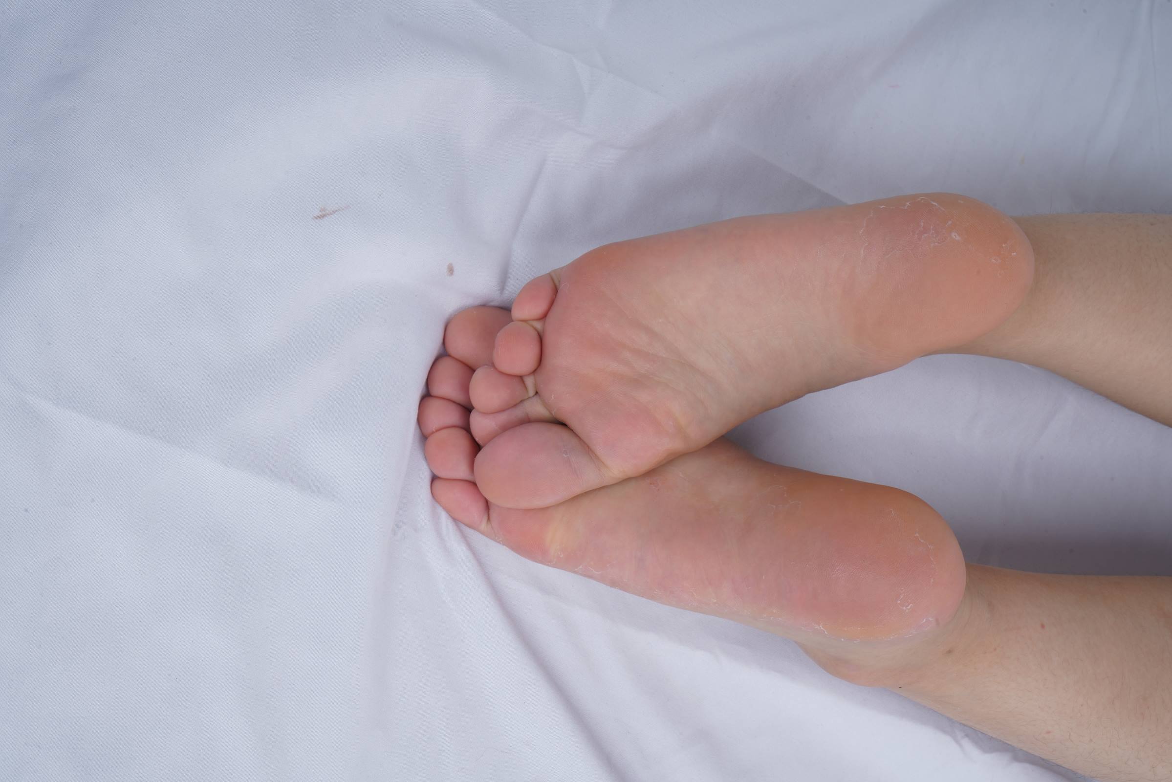 图片[58]-Pary摄影 NO.108 可爱小美女燕玲请吃美脚大餐[103P] – 速更版-美库