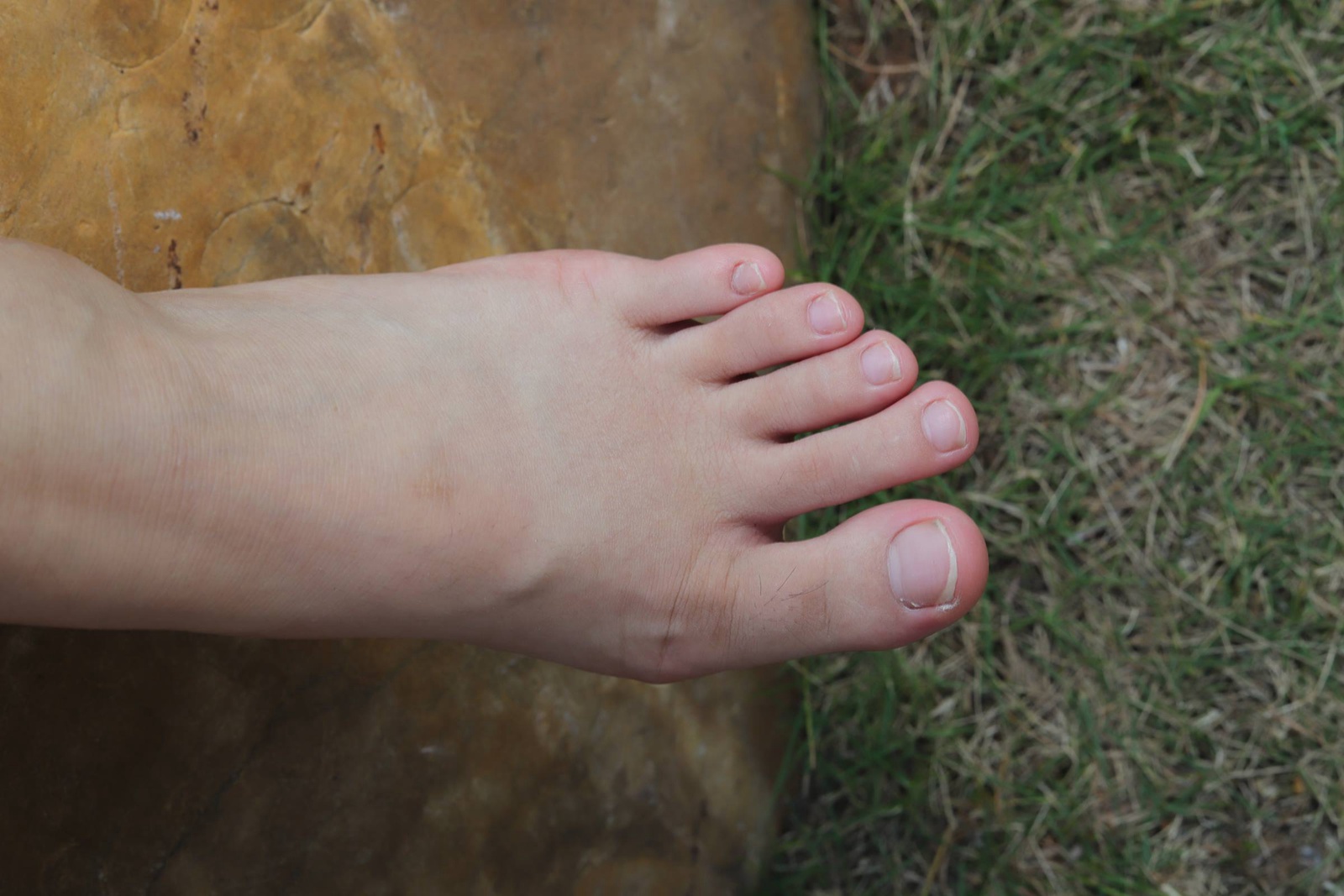 图片[96]-Pary摄影 NO.110 大学生小然户外展示37码嫩脚[98P] – 速更版-美库