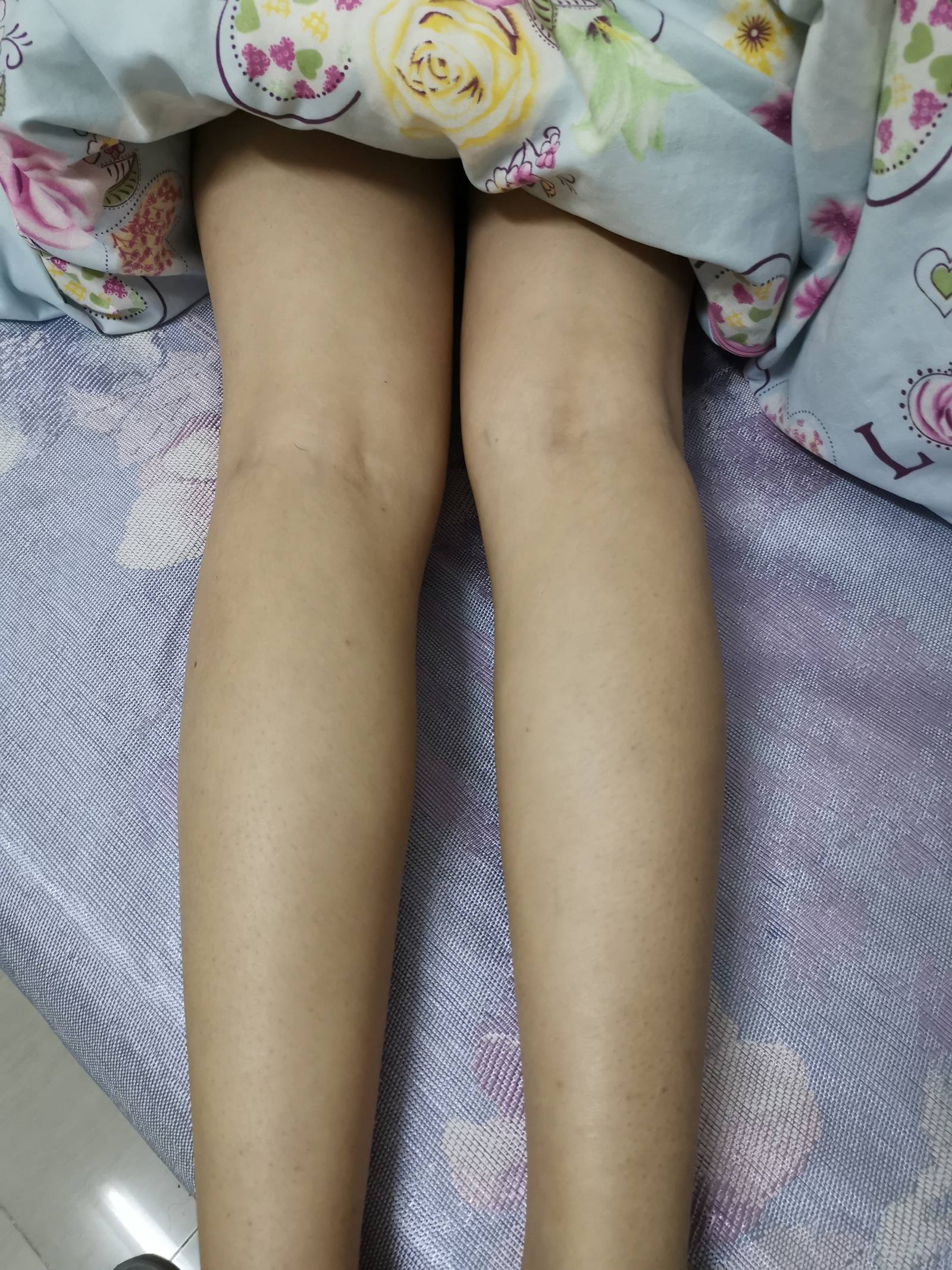 图片[14]-鱼鱼足影@010-第10期：Lucky[190P] – 速更版-美库