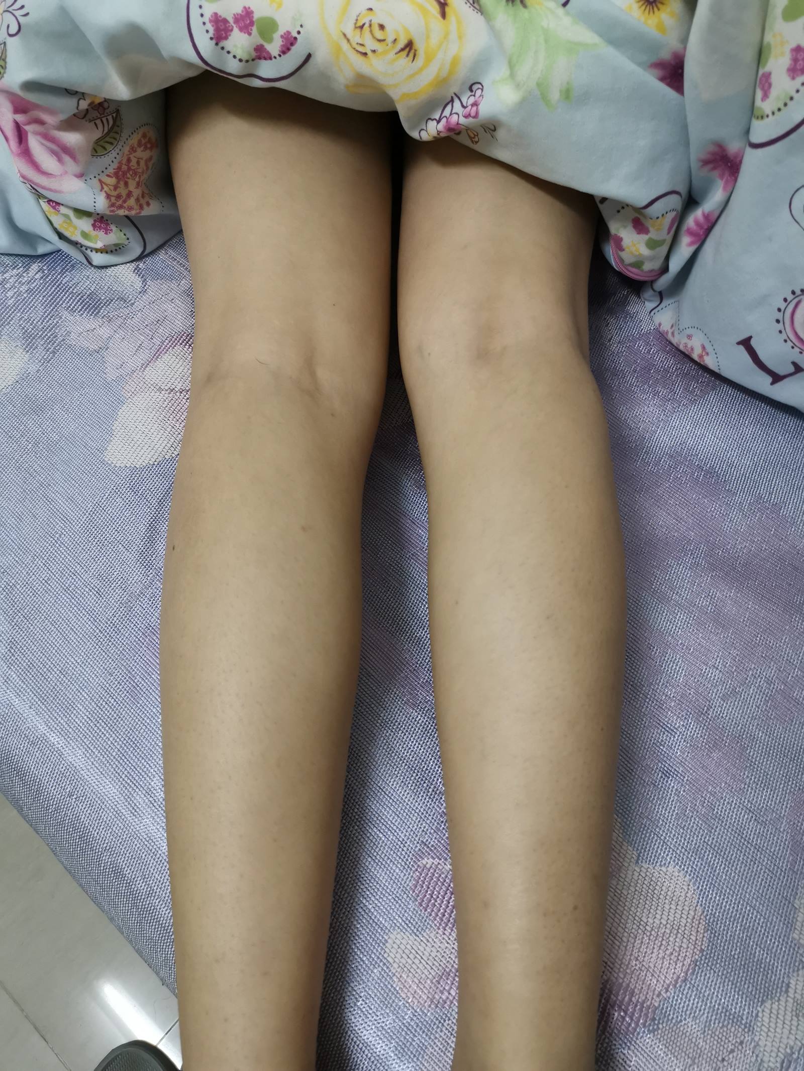 图片[15]-鱼鱼足影@010-第10期：Lucky[190P] – 速更版-美库