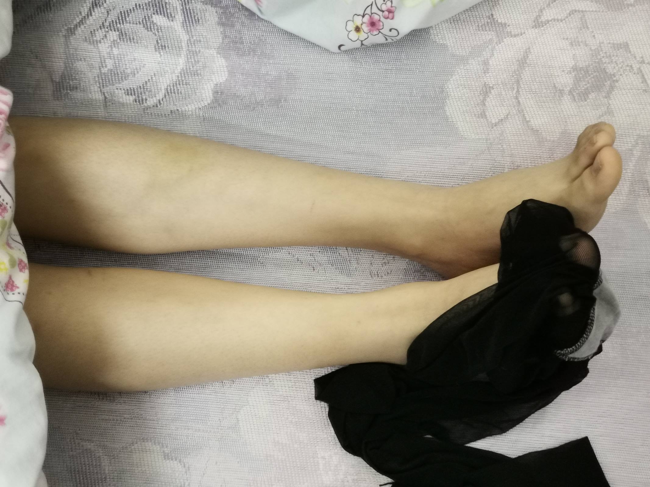 图片[36]-鱼鱼足影@010-第10期：Lucky[190P] – 速更版-美库