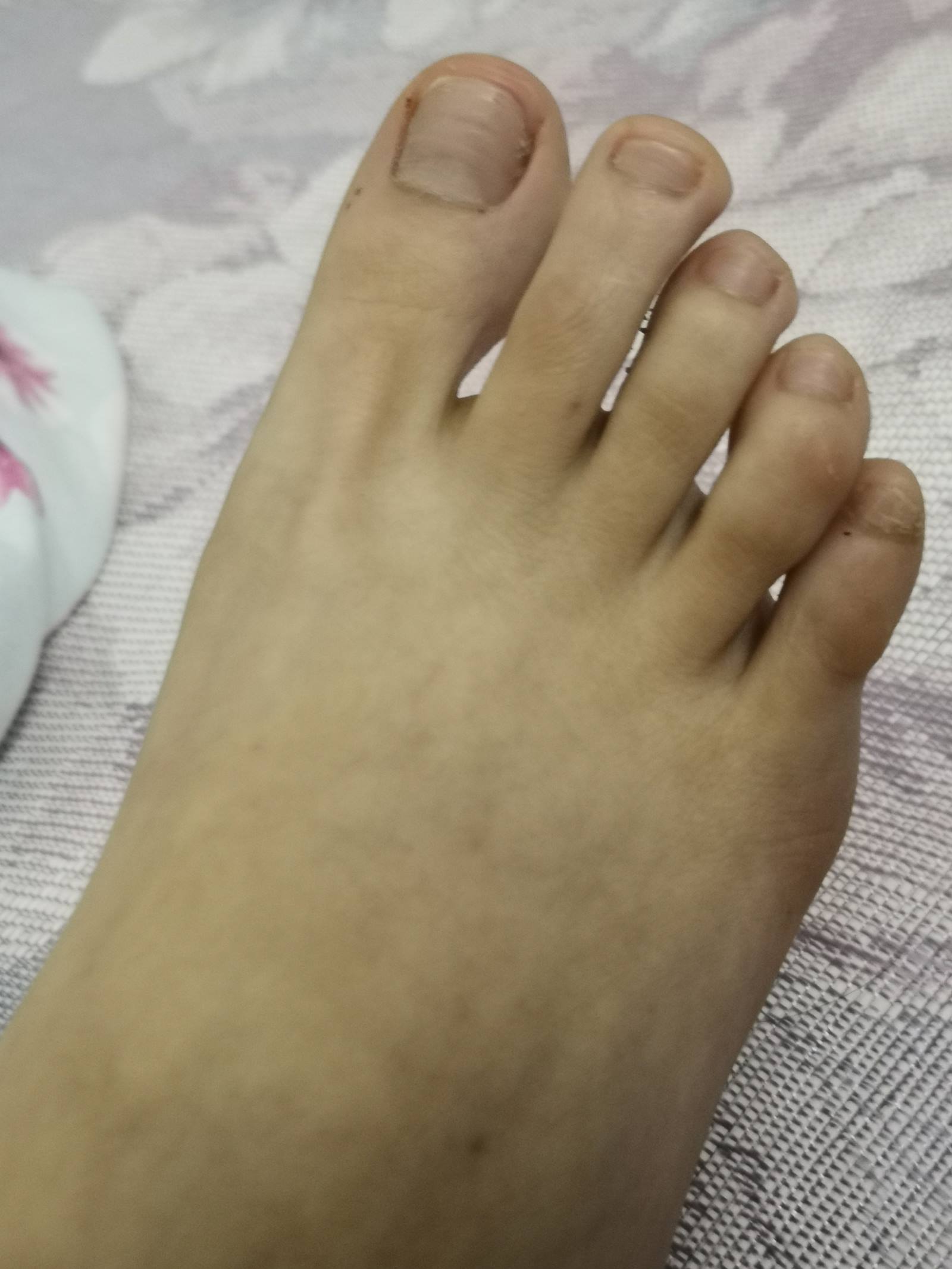 图片[42]-鱼鱼足影@010-第10期：Lucky[190P] – 速更版-美库