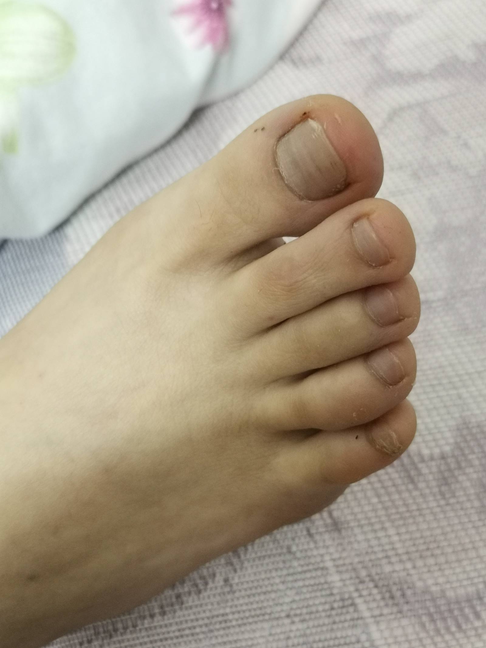 图片[47]-鱼鱼足影@010-第10期：Lucky[190P] – 速更版-美库