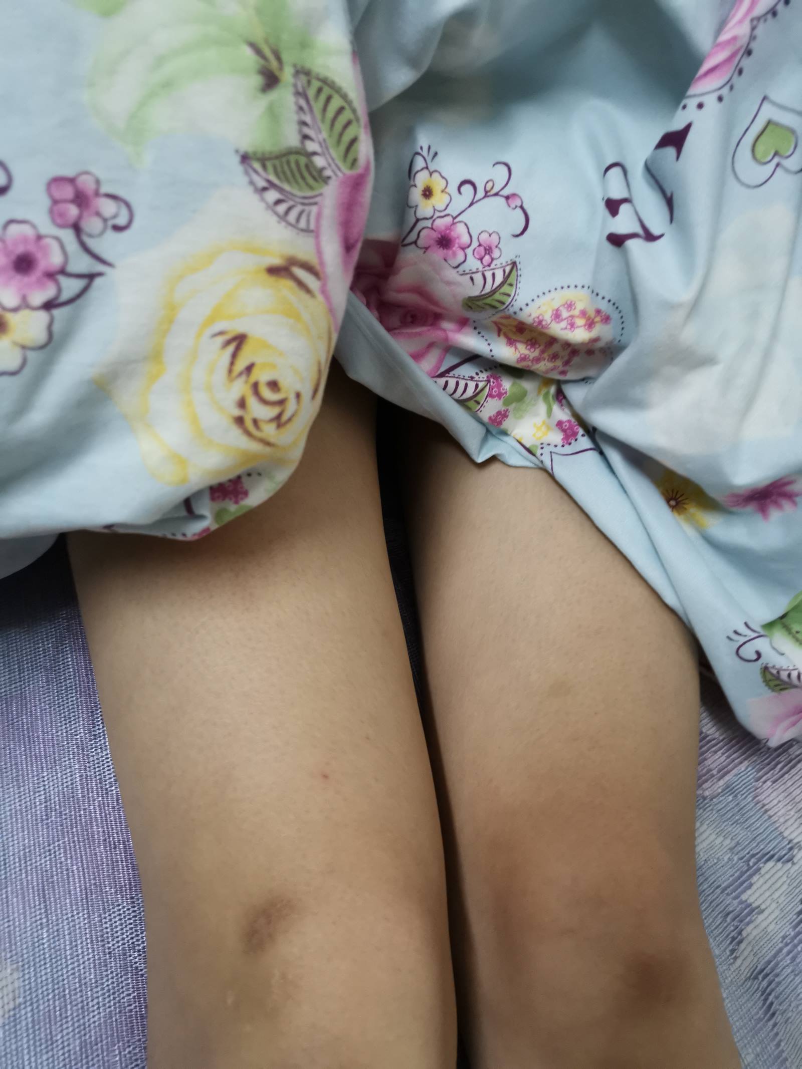 图片[56]-鱼鱼足影@010-第10期：Lucky[190P] – 速更版-美库