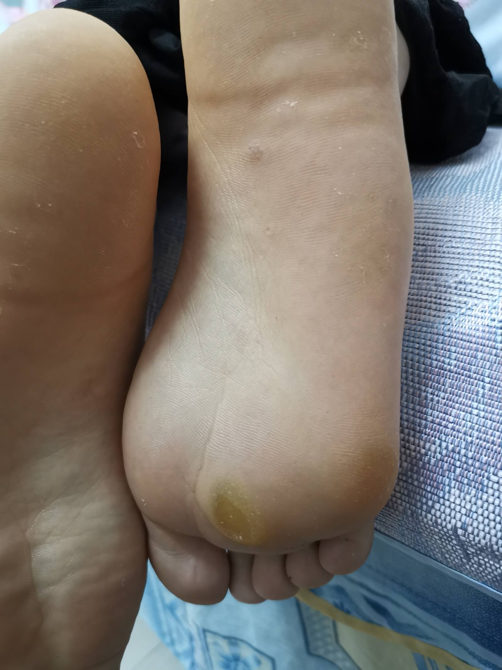 图片[191]-鱼鱼足影@010-第10期：Lucky[190P] – 速更版-美库