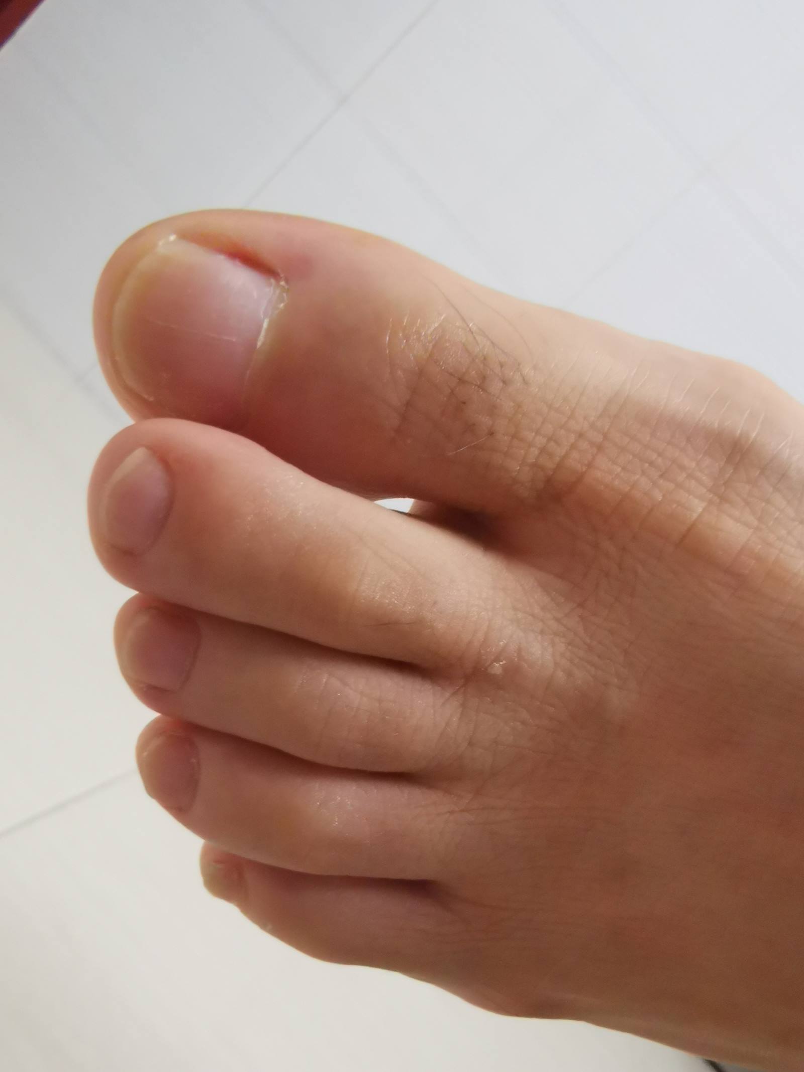 图片[68]-鱼鱼足影@013-第13期：毛毛鞋[109P] – 速更版-美库