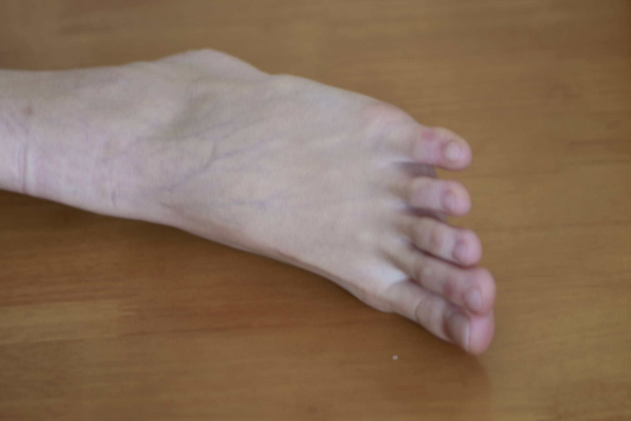 图片[155]-鱼鱼足影@016-第16期：周周[180P] – 速更版-美库