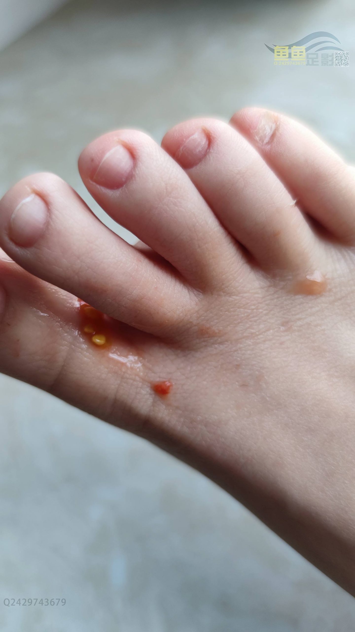 图片[158]-鱼鱼足影@035-第35期：静静[177P] – 速更版-美库