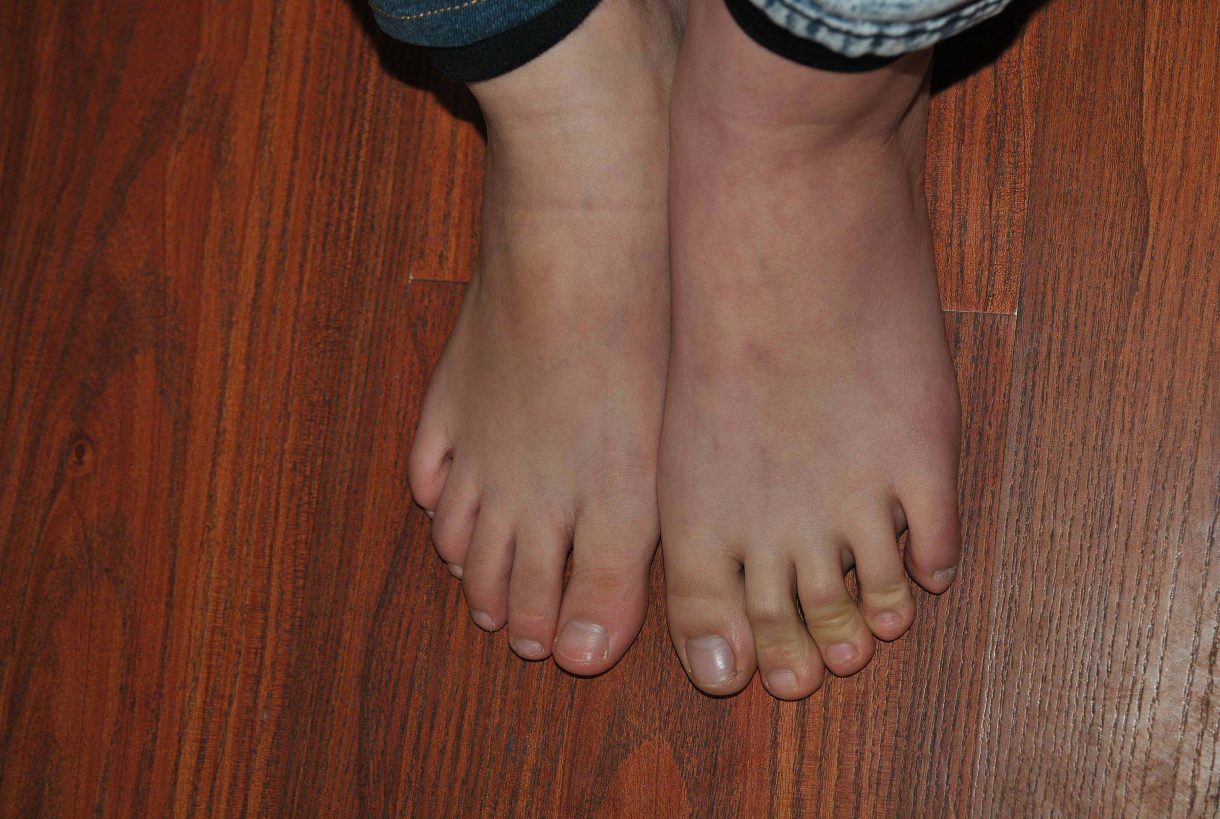 图片[28]-自由摄影 No.039 楠楠 齐齐 裸足比脚 [61P] – 速更版-美库