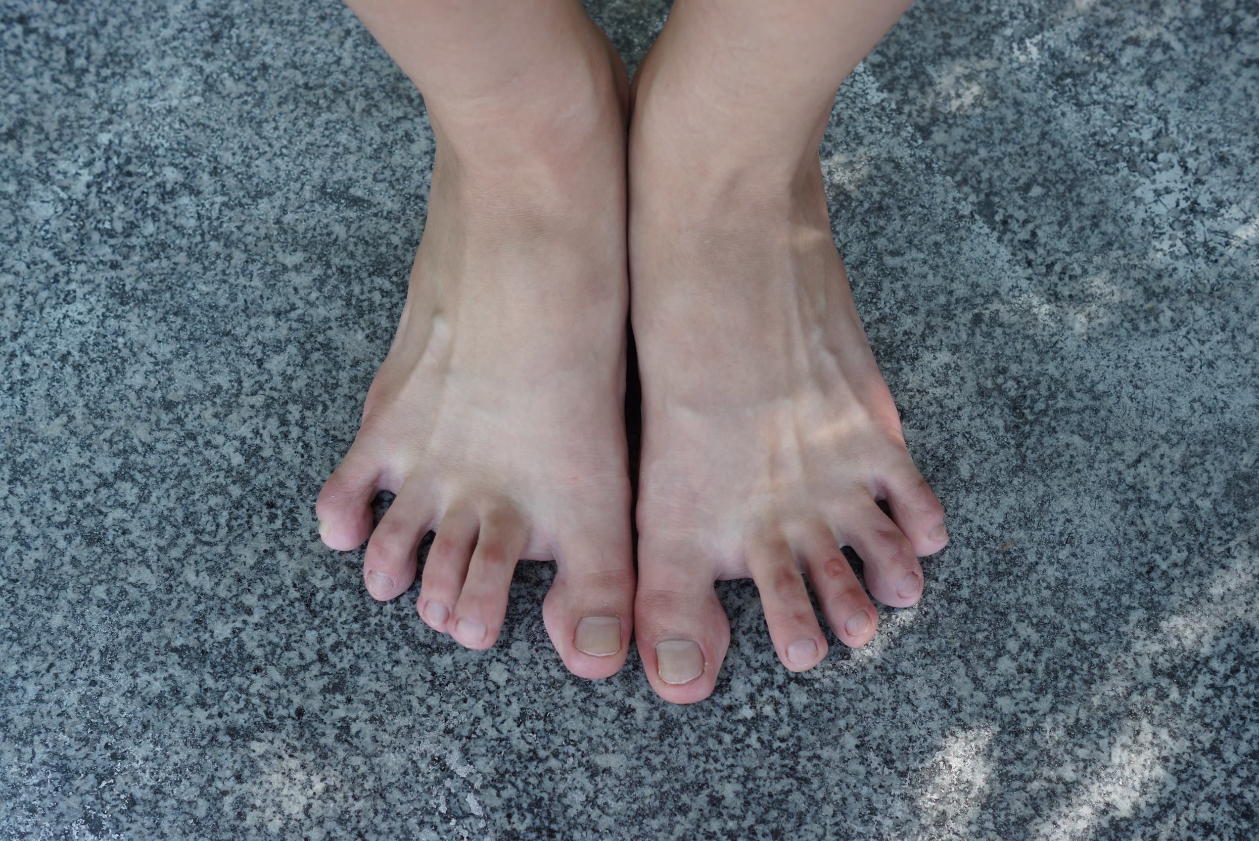 图片[20]-自由摄影 No.117 俏丽的脸蛋，纤细的玉足 [92P] – 速更版-美库